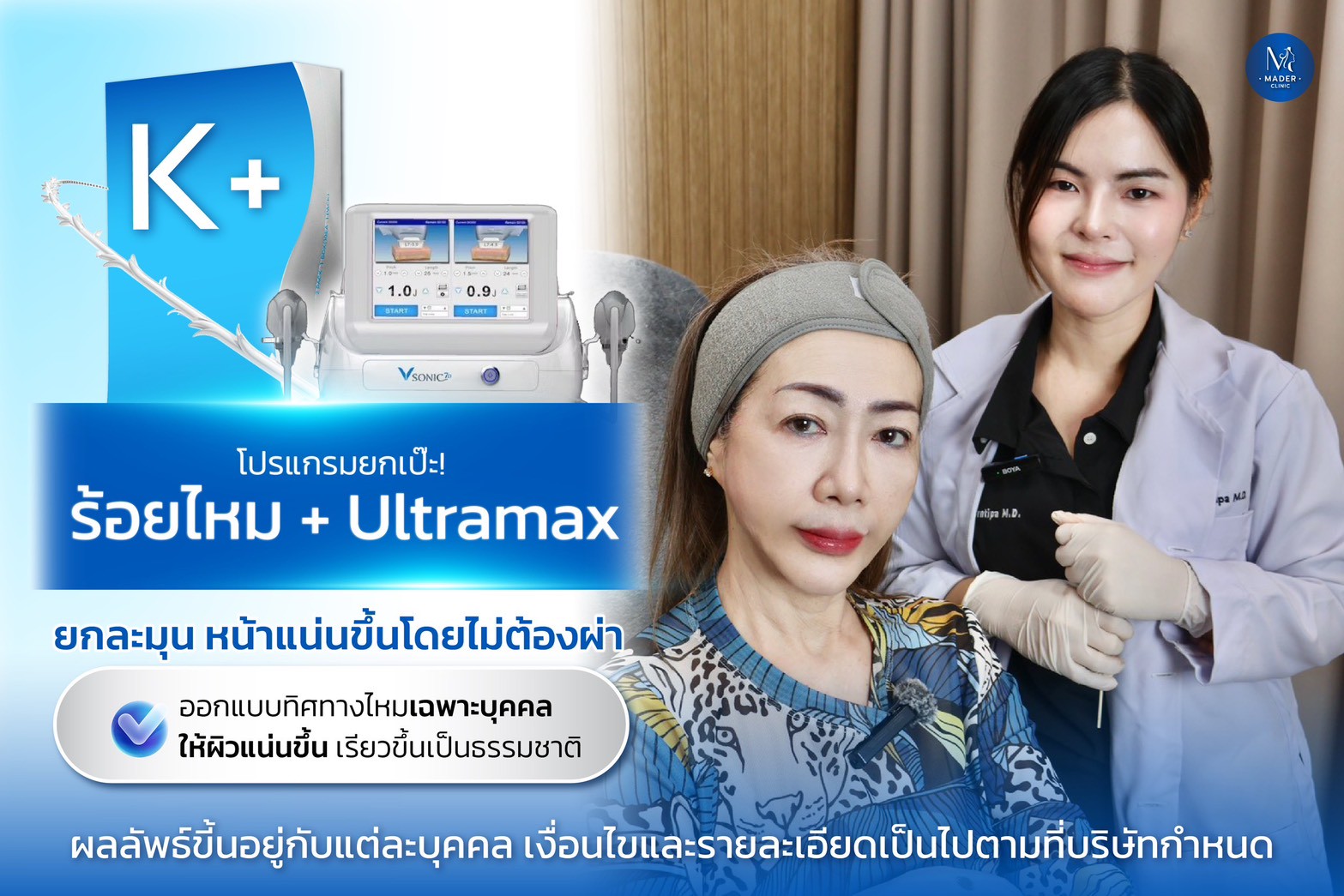 Ultramax HIFU 300 Shots