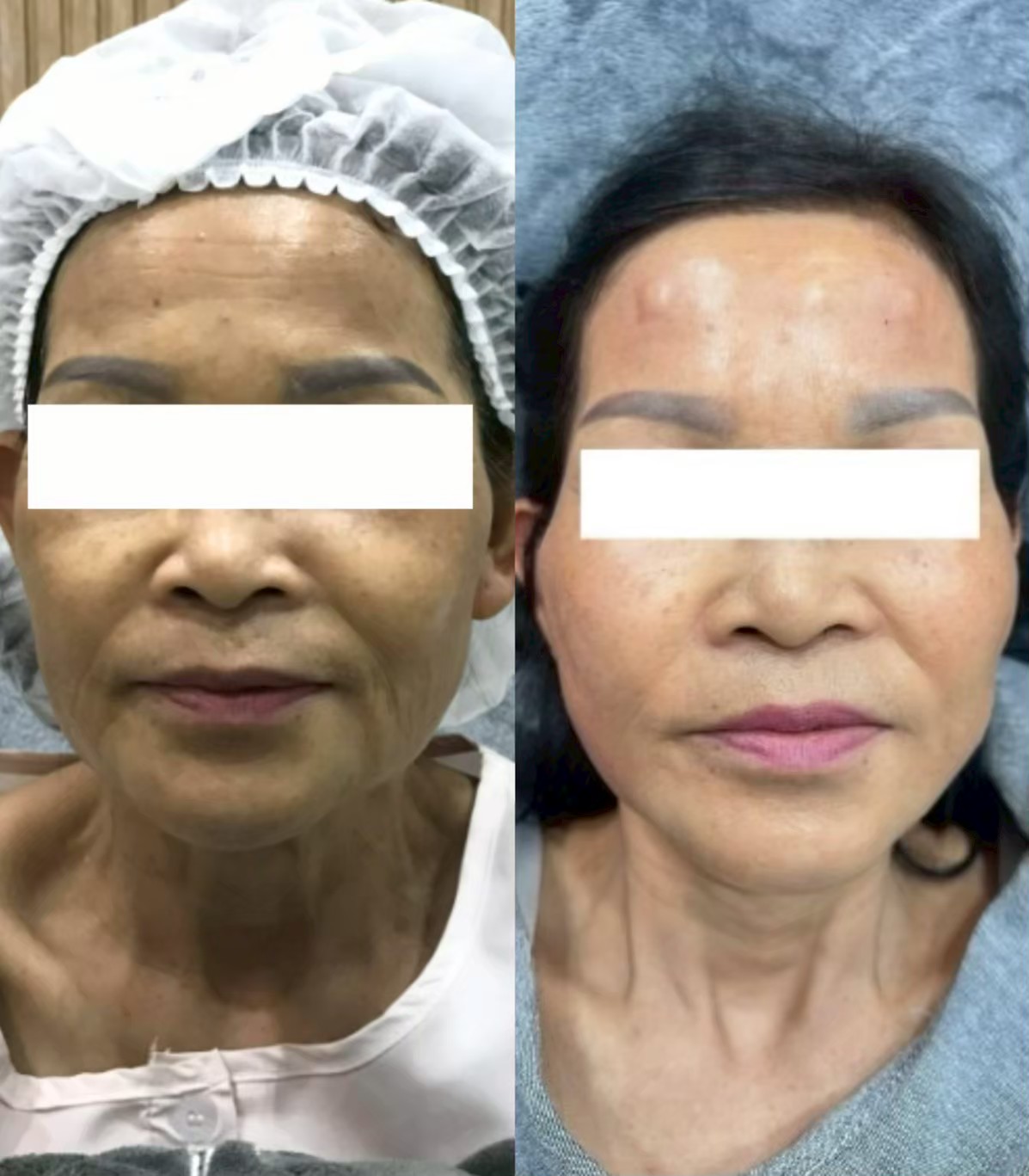 รีวิว MADER Clinic