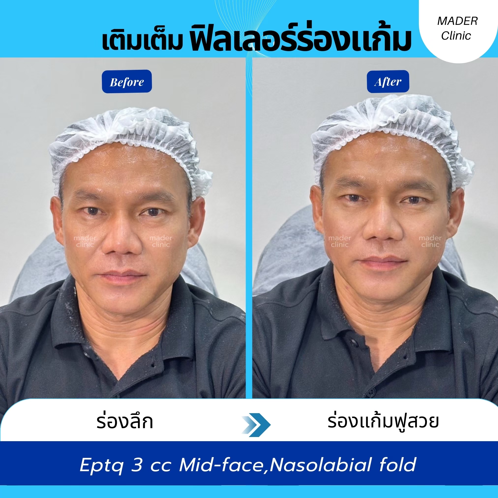 รีวิว MADER Clinic