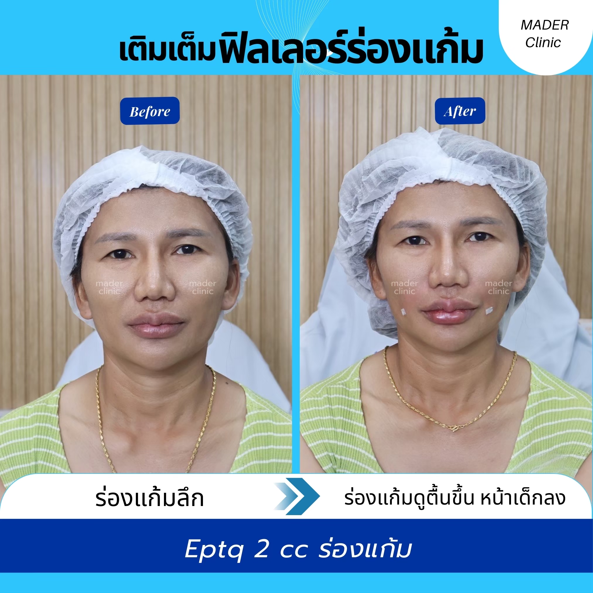รีวิว MADER Clinic