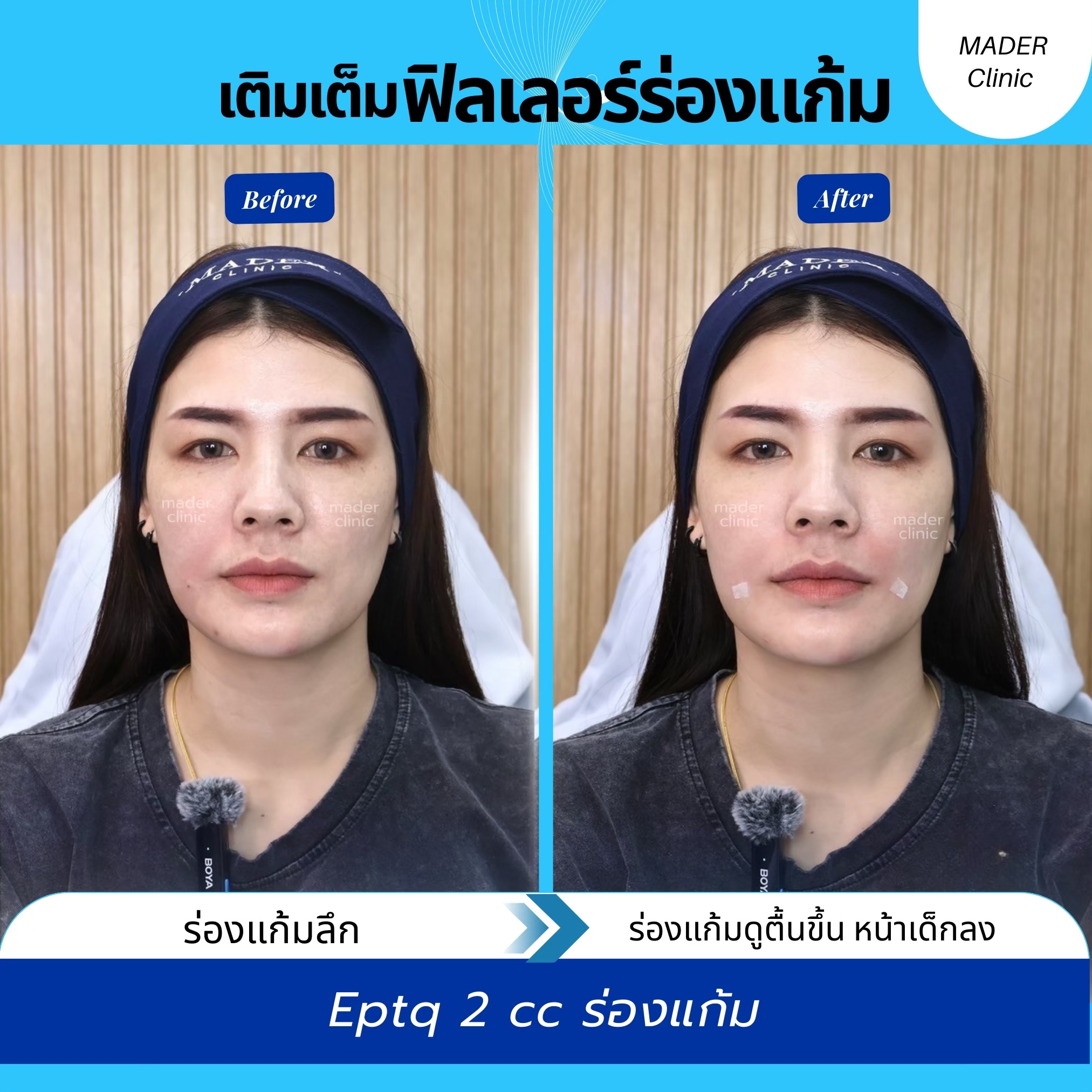 รีวิว MADER Clinic