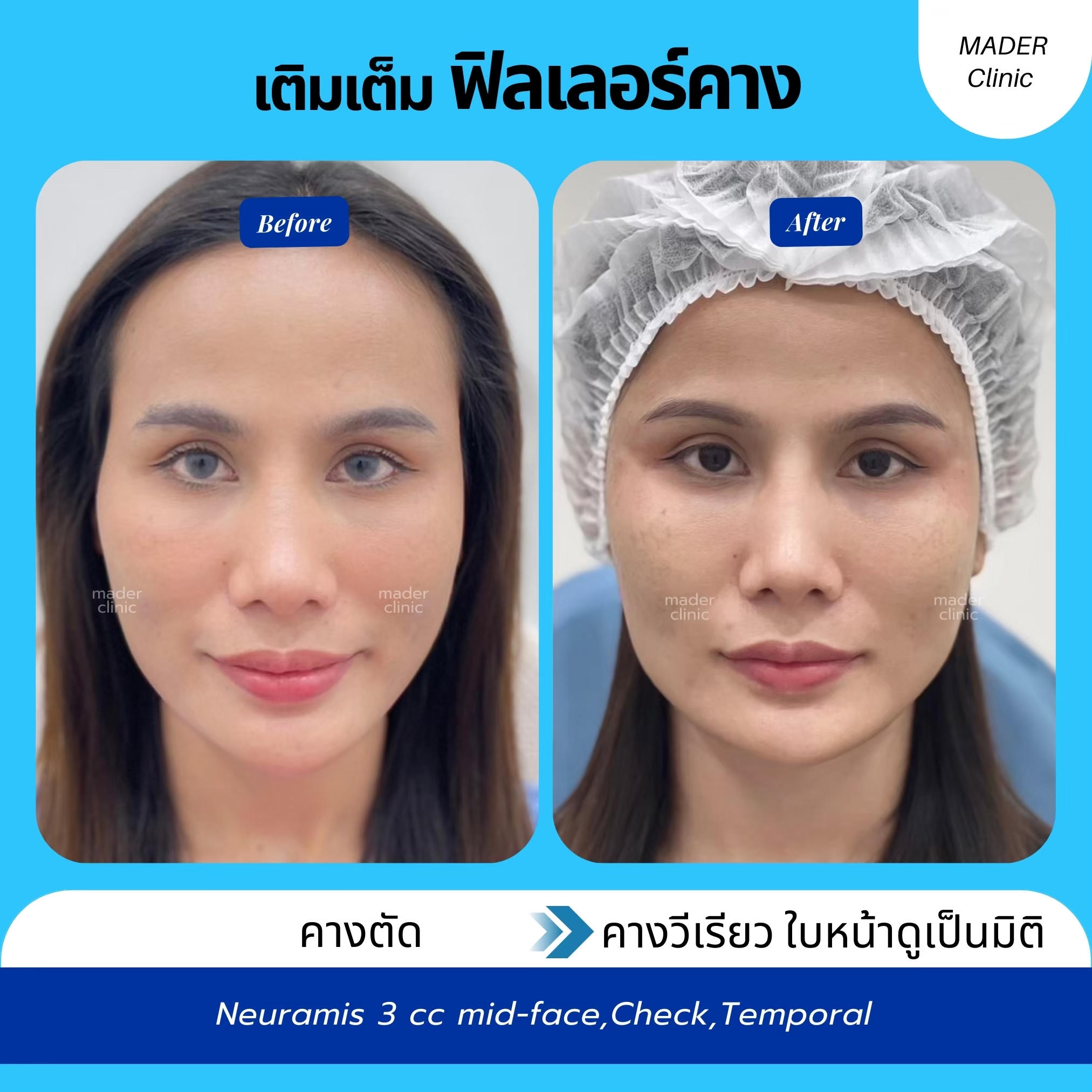 รีวิว MADER Clinic