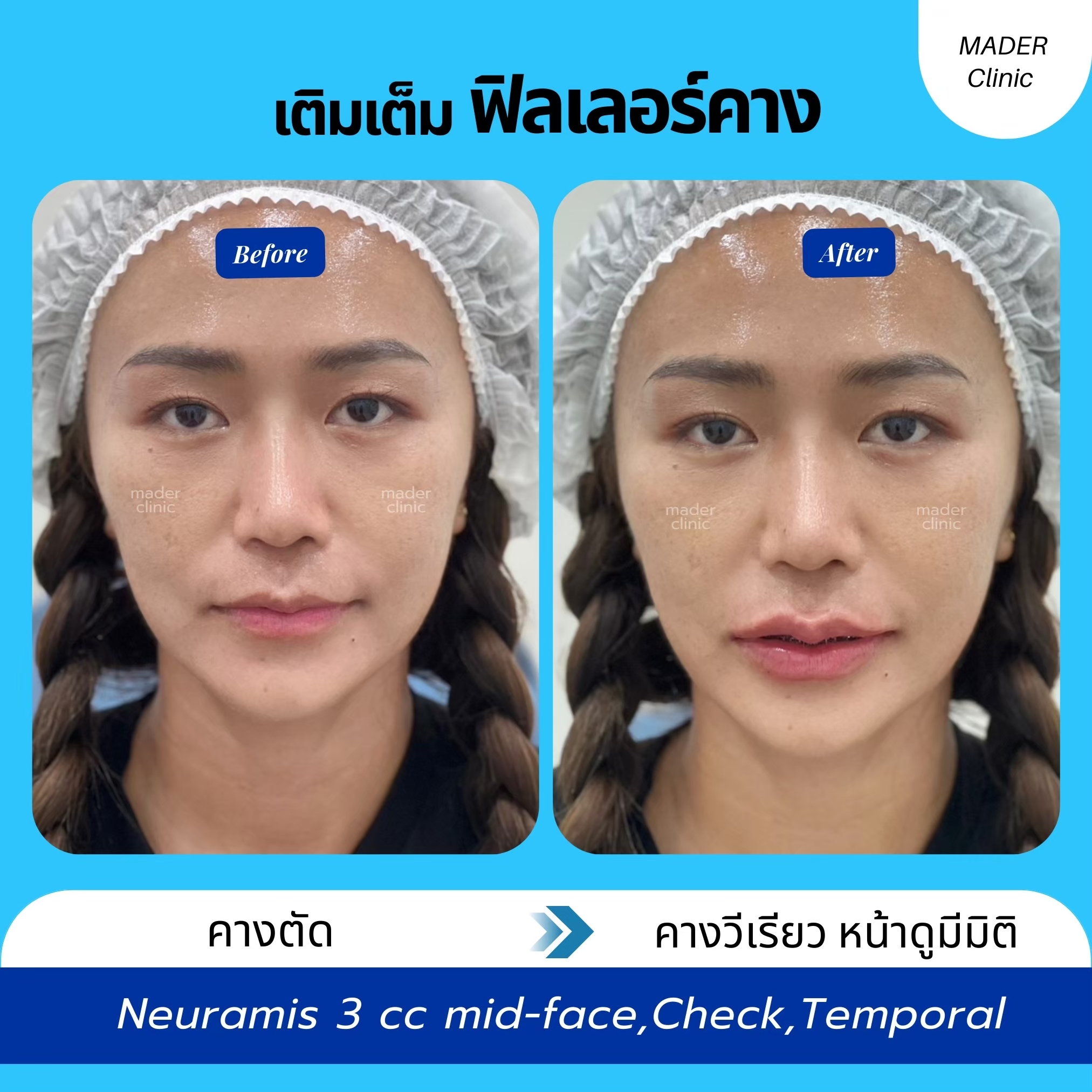 รีวิว MADER Clinic