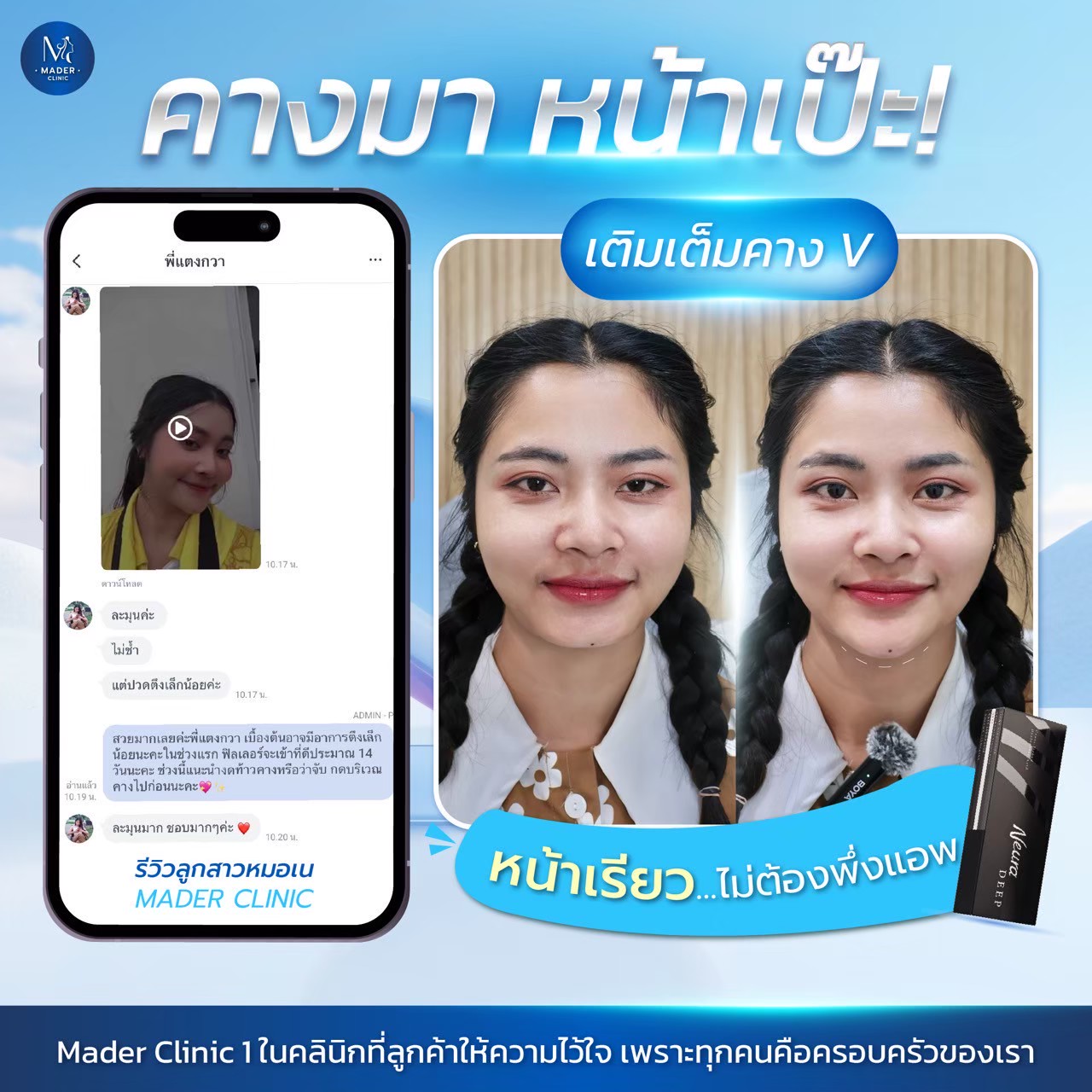 รีวิว MADER Clinic