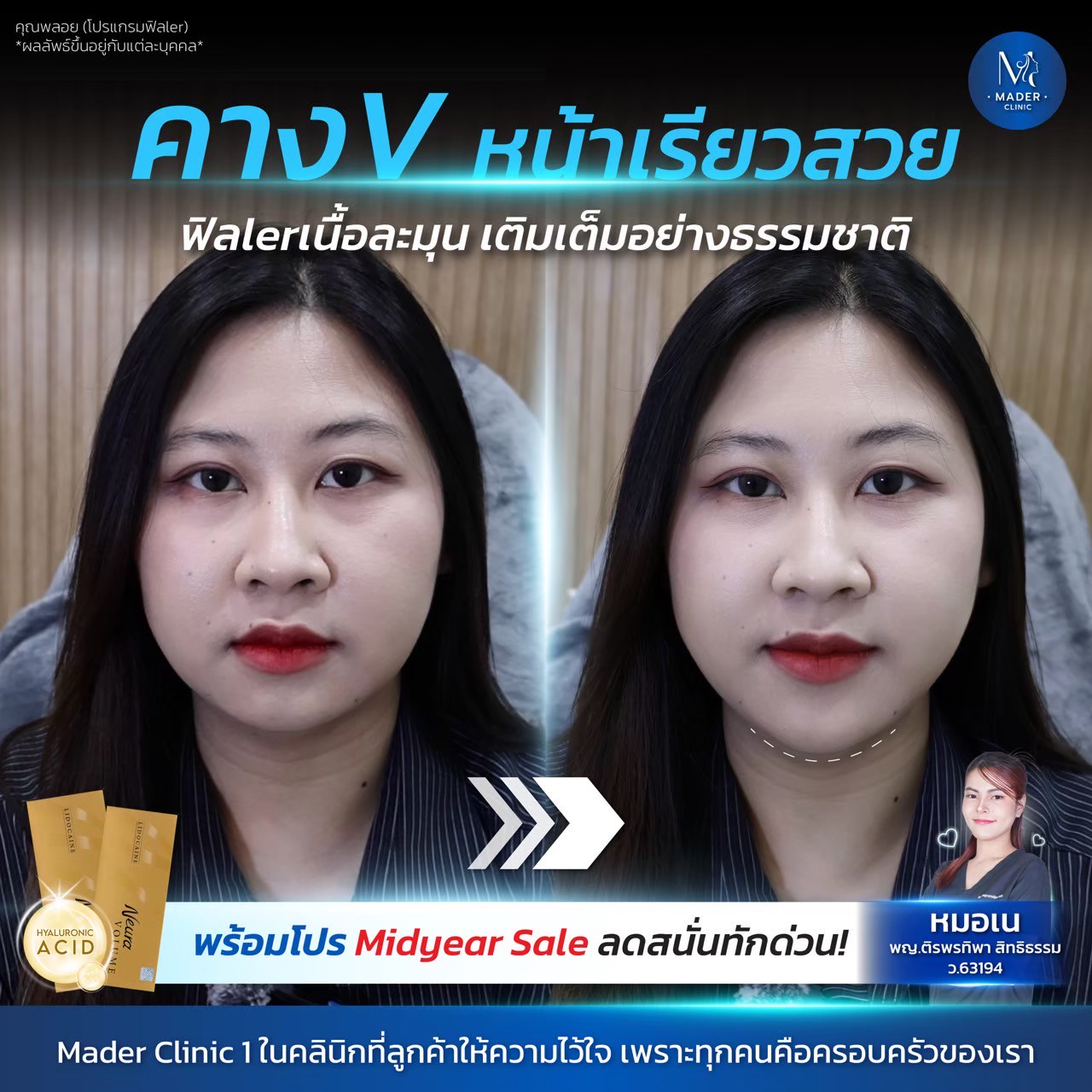รีวิว MADER Clinic
