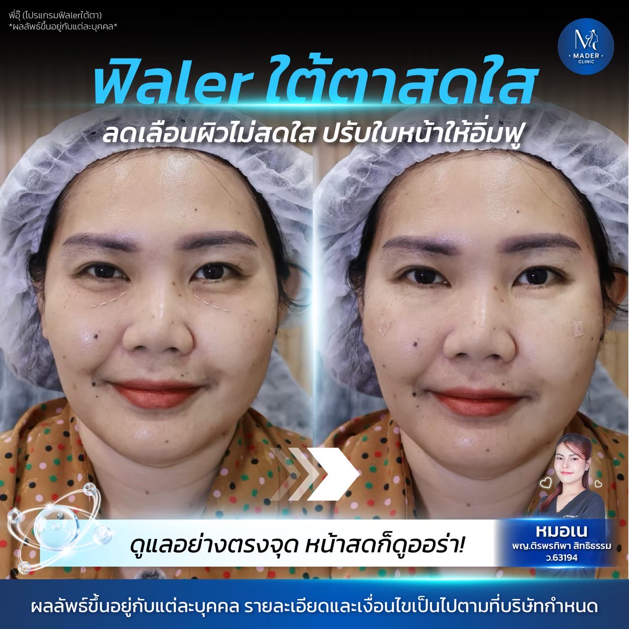 รีวิว MADER Clinic