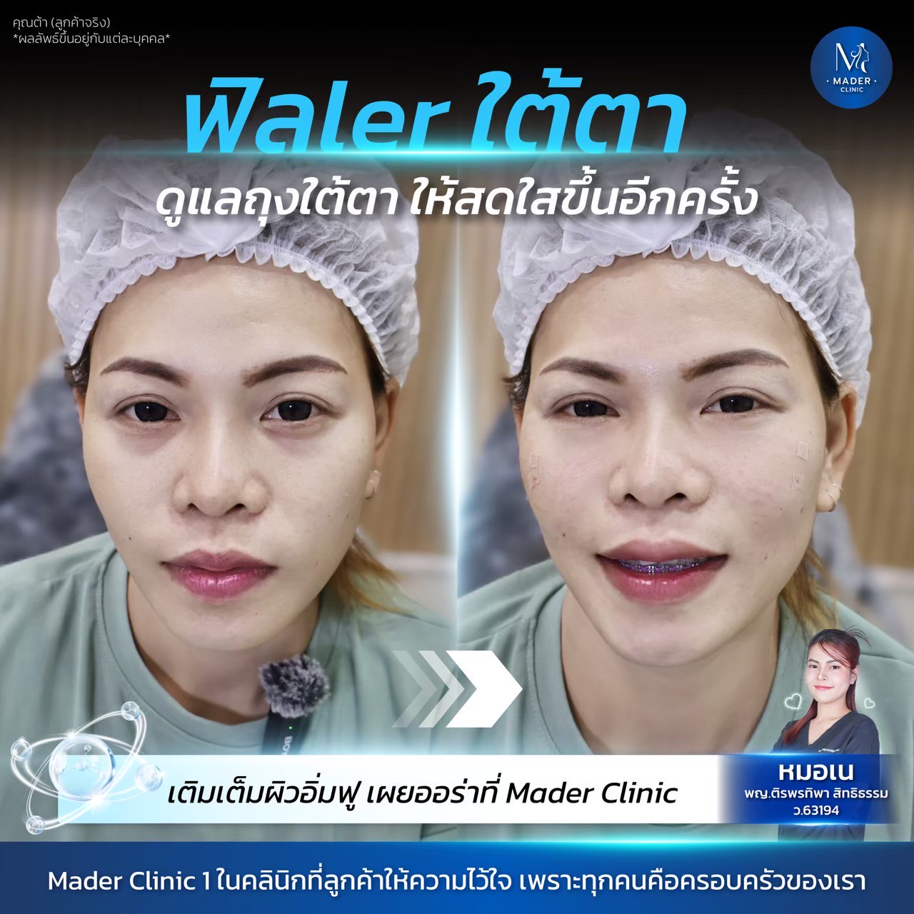 รีวิว MADER Clinic