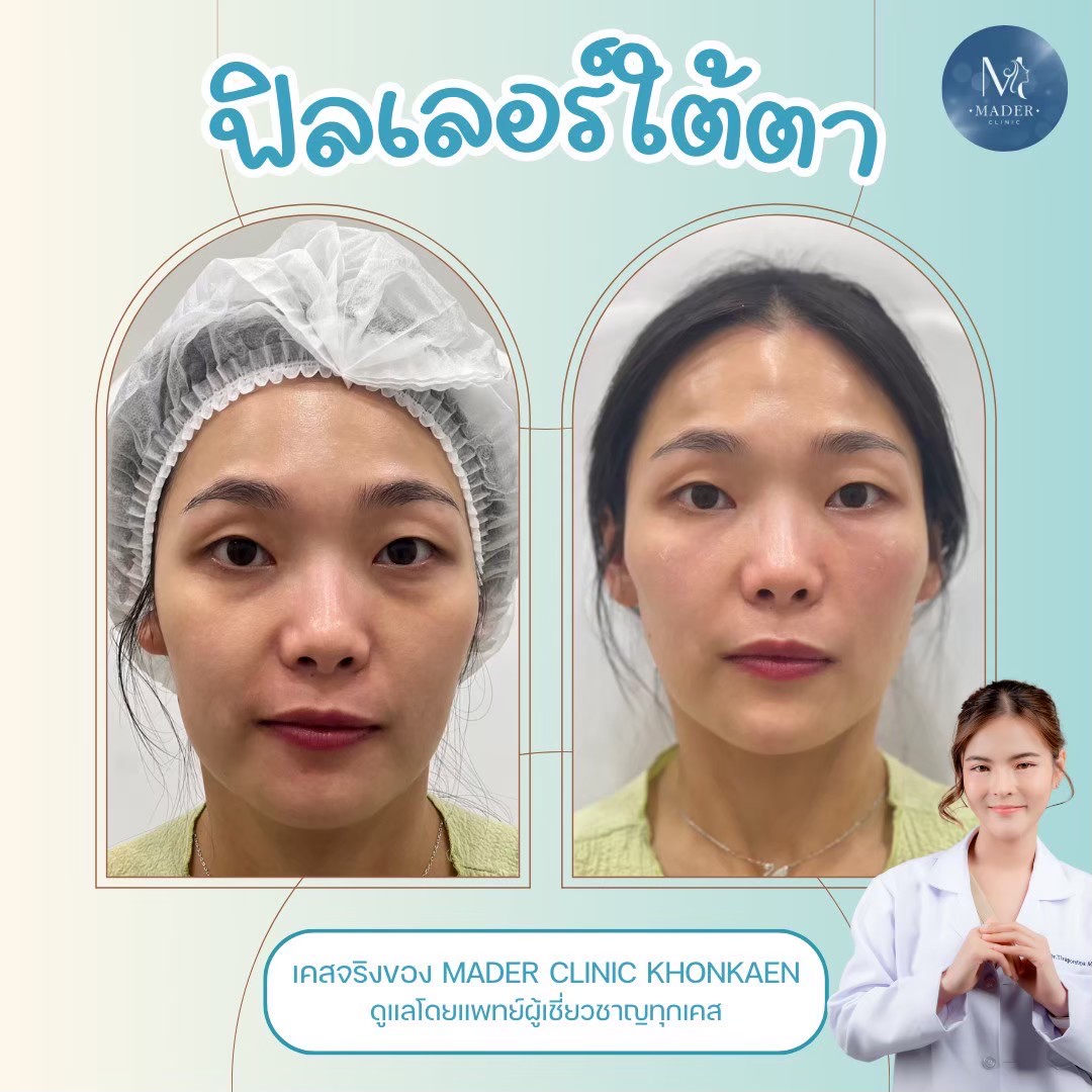 รีวิว MADER Clinic