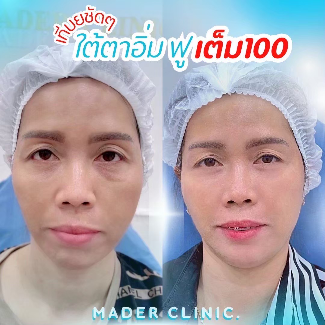 รีวิว MADER Clinic
