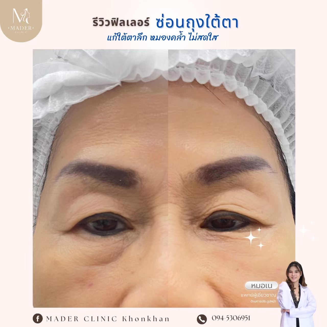 รีวิว MADER Clinic
