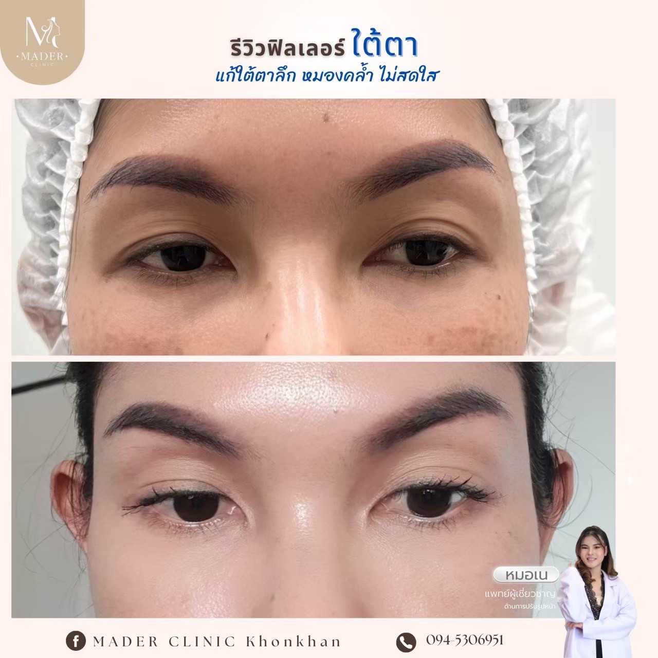 รีวิว MADER Clinic