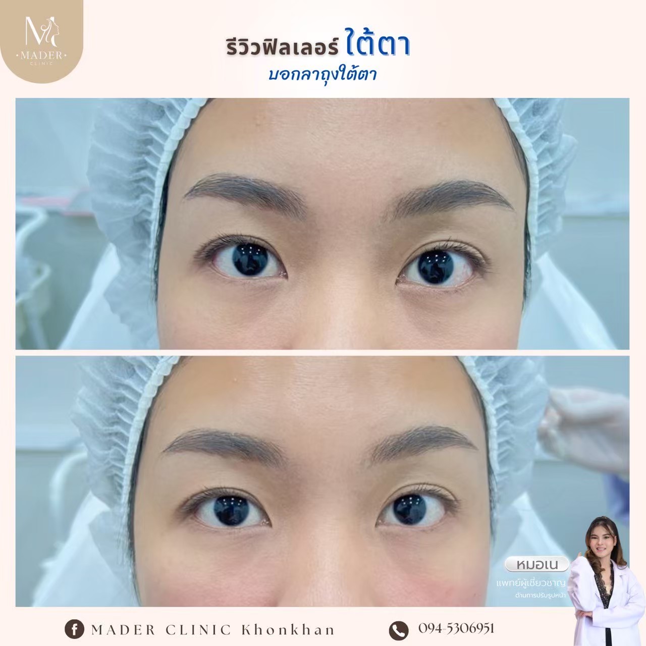 รีวิว MADER Clinic