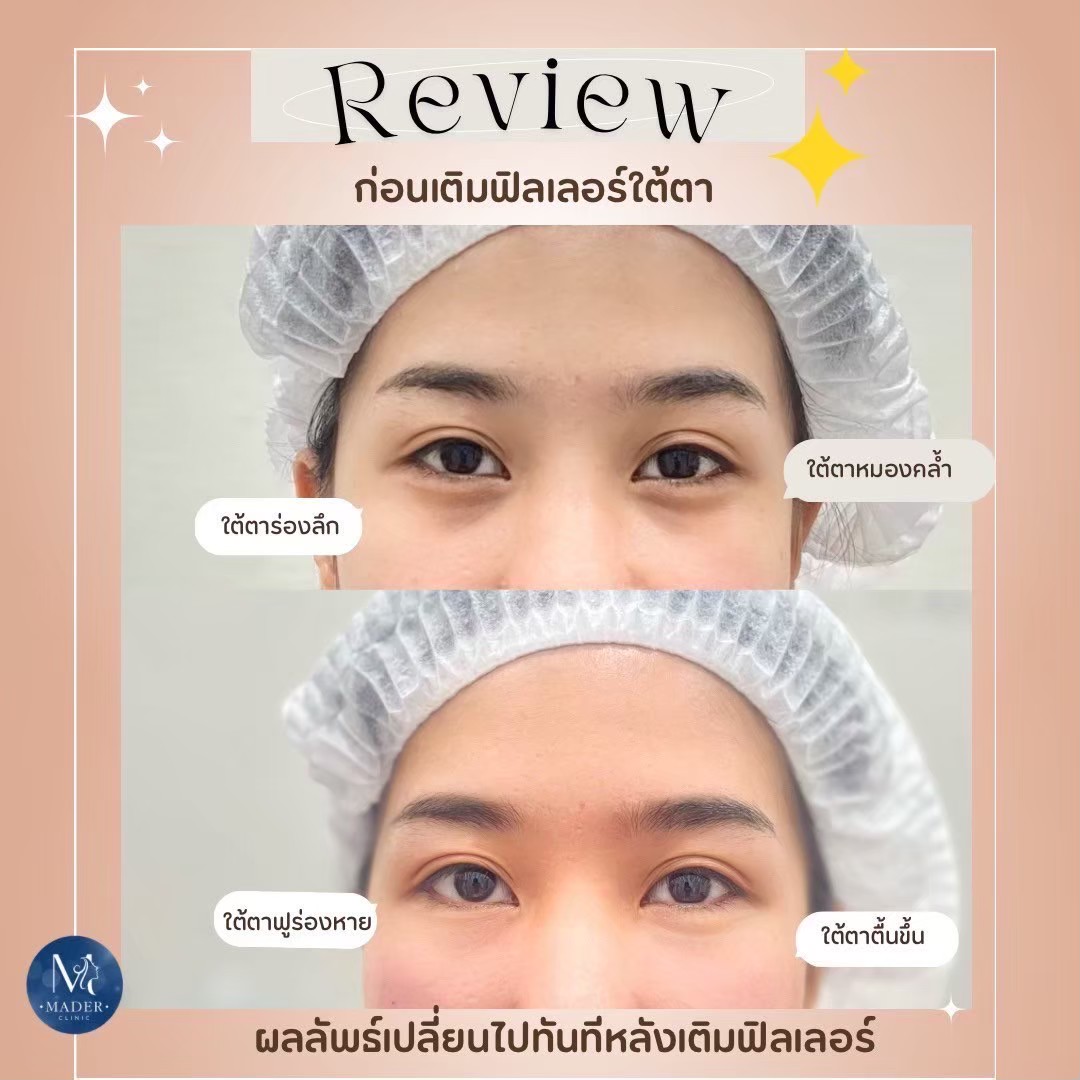 รีวิว MADER Clinic