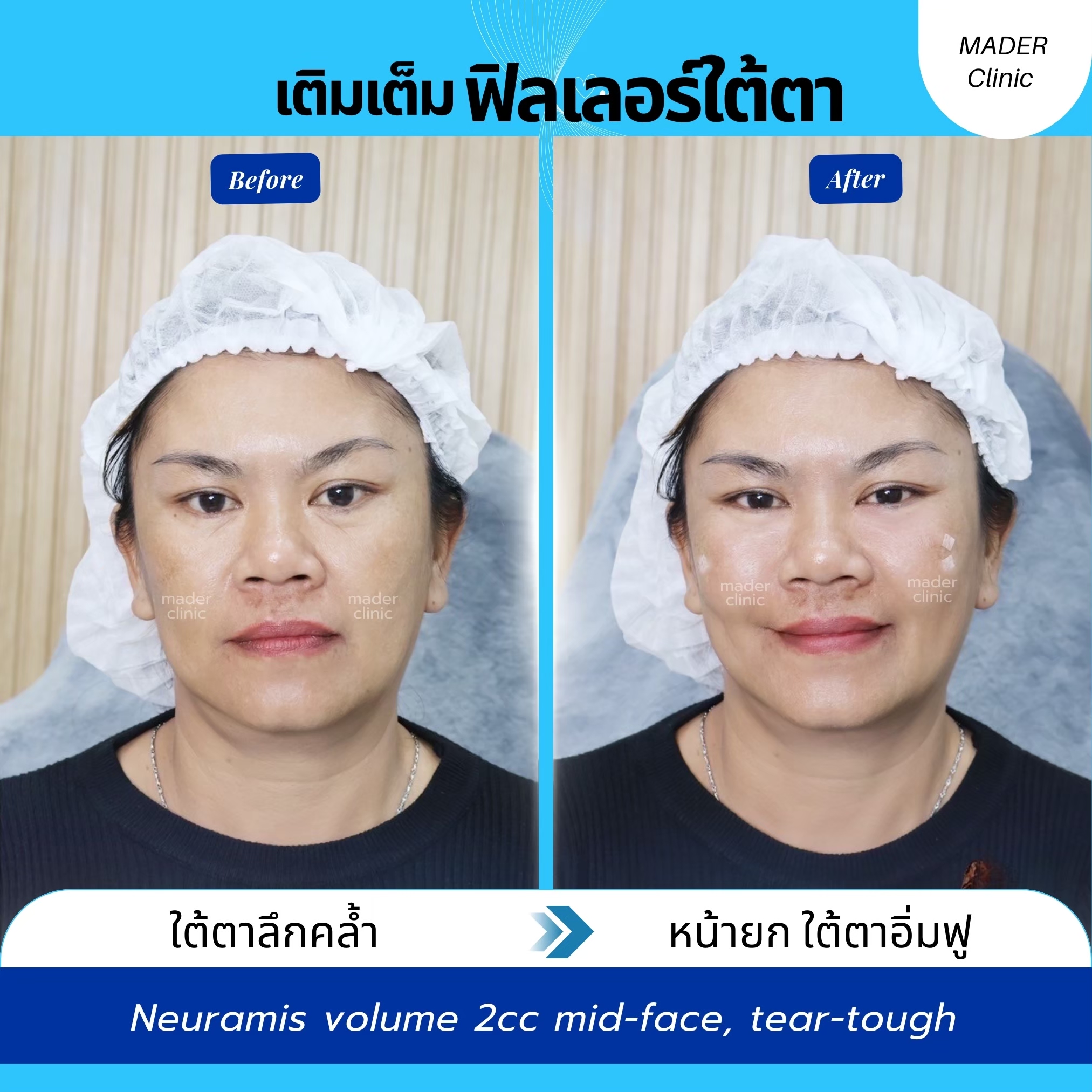 รีวิว MADER Clinic