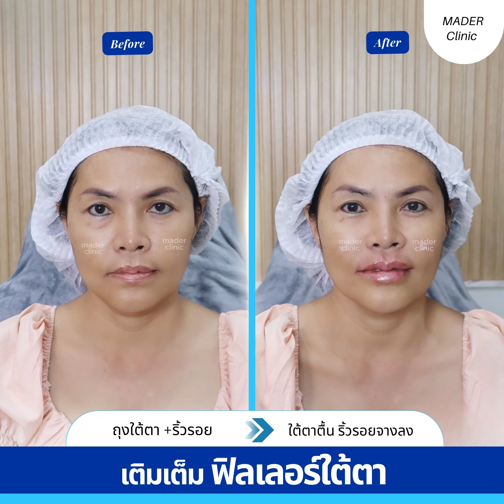 รีวิว MADER Clinic