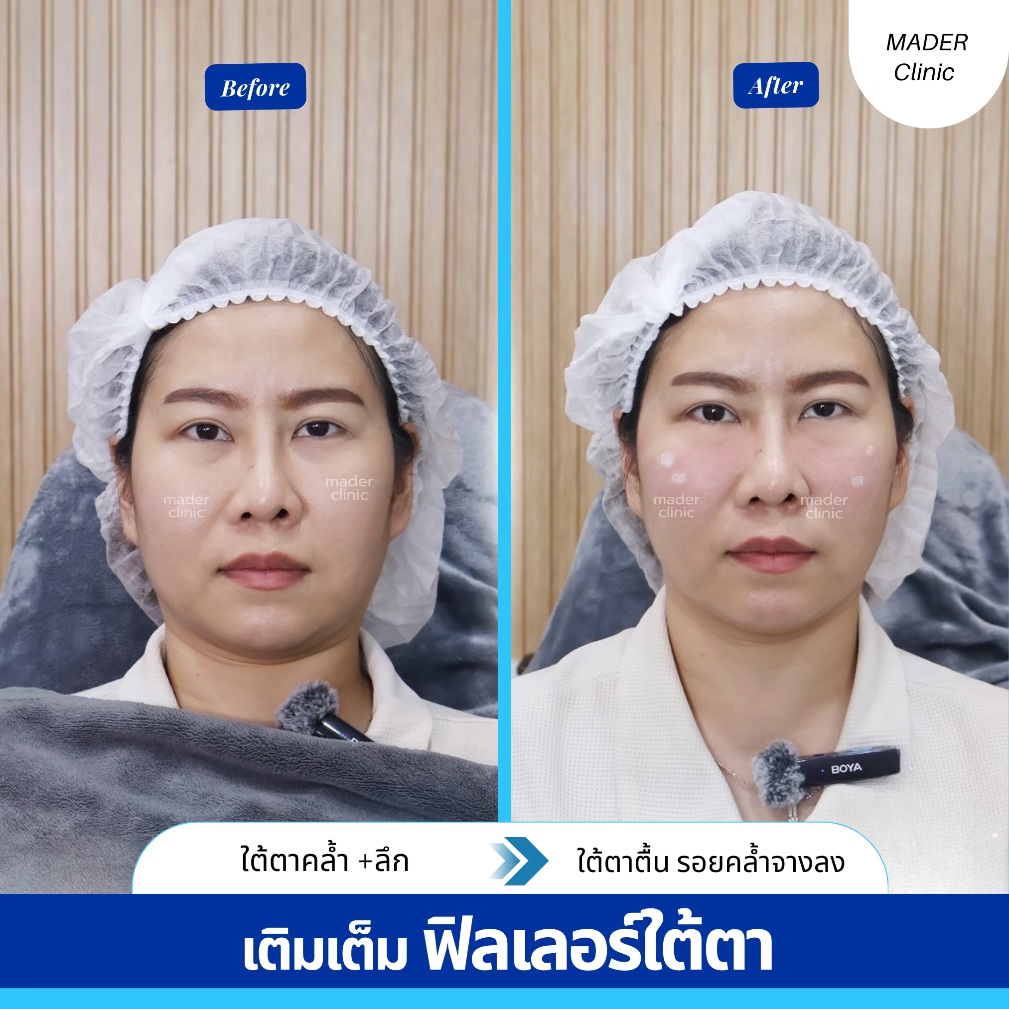 รีวิว MADER Clinic