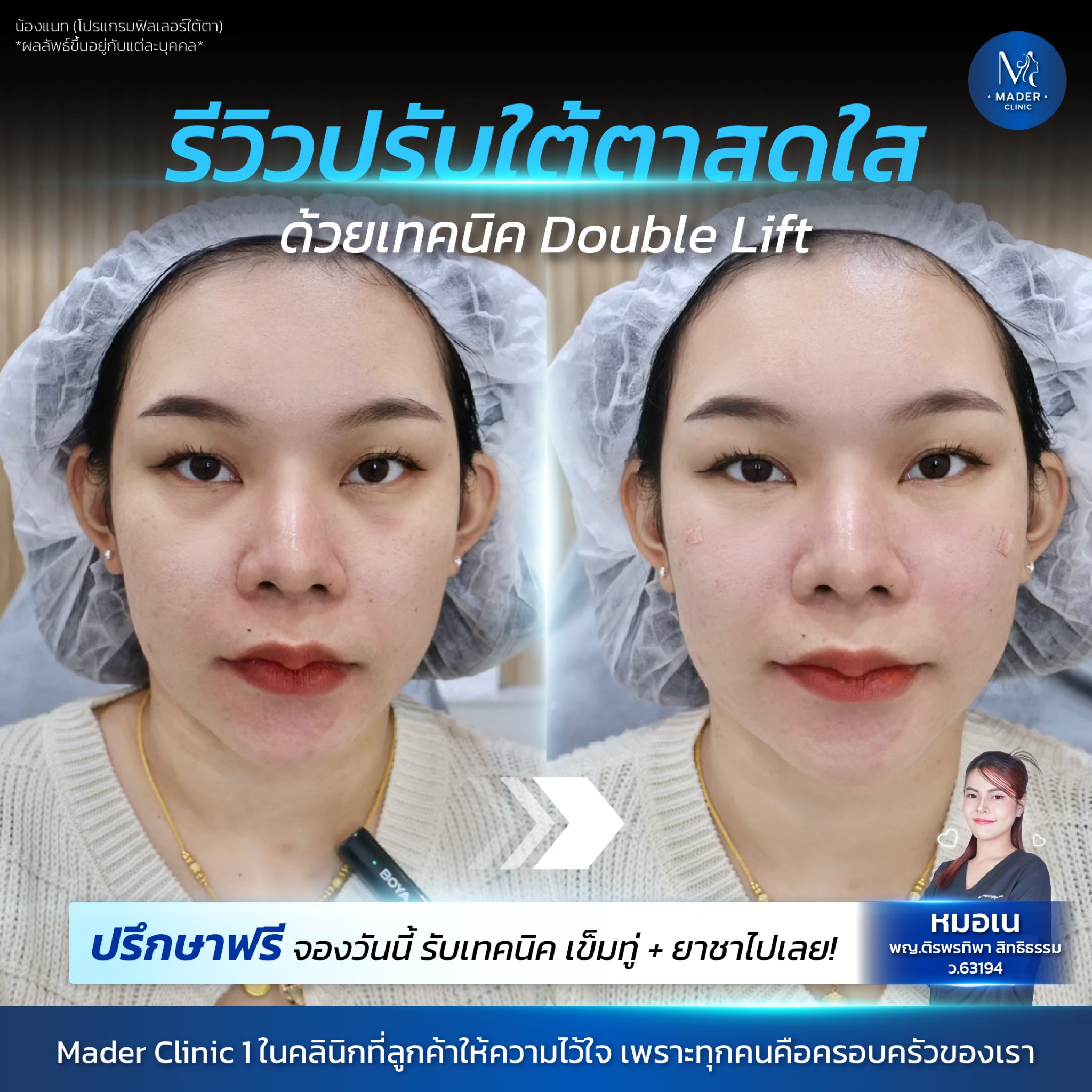 รีวิว MADER Clinic
