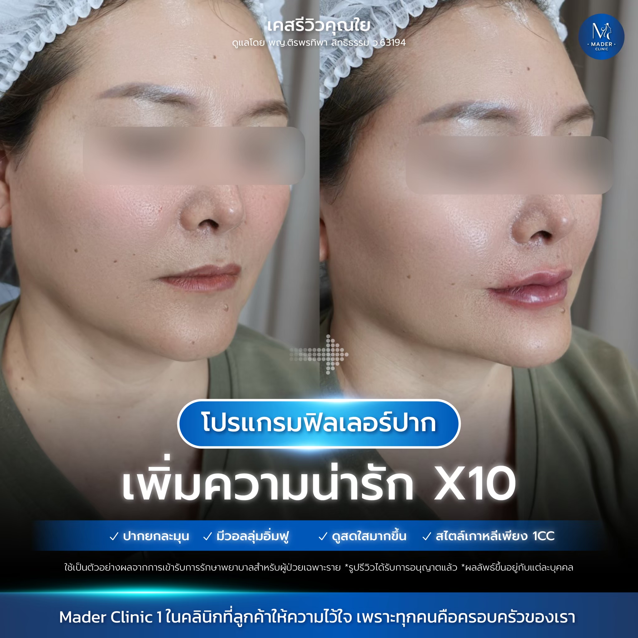 รีวิว MADER Clinic