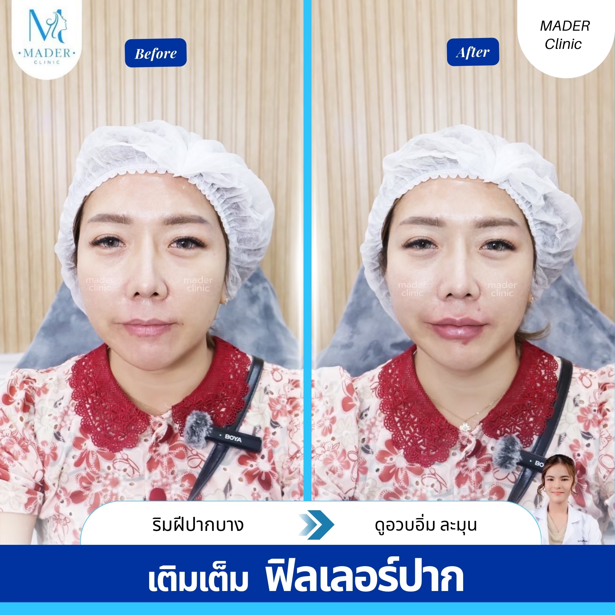 รีวิว MADER Clinic