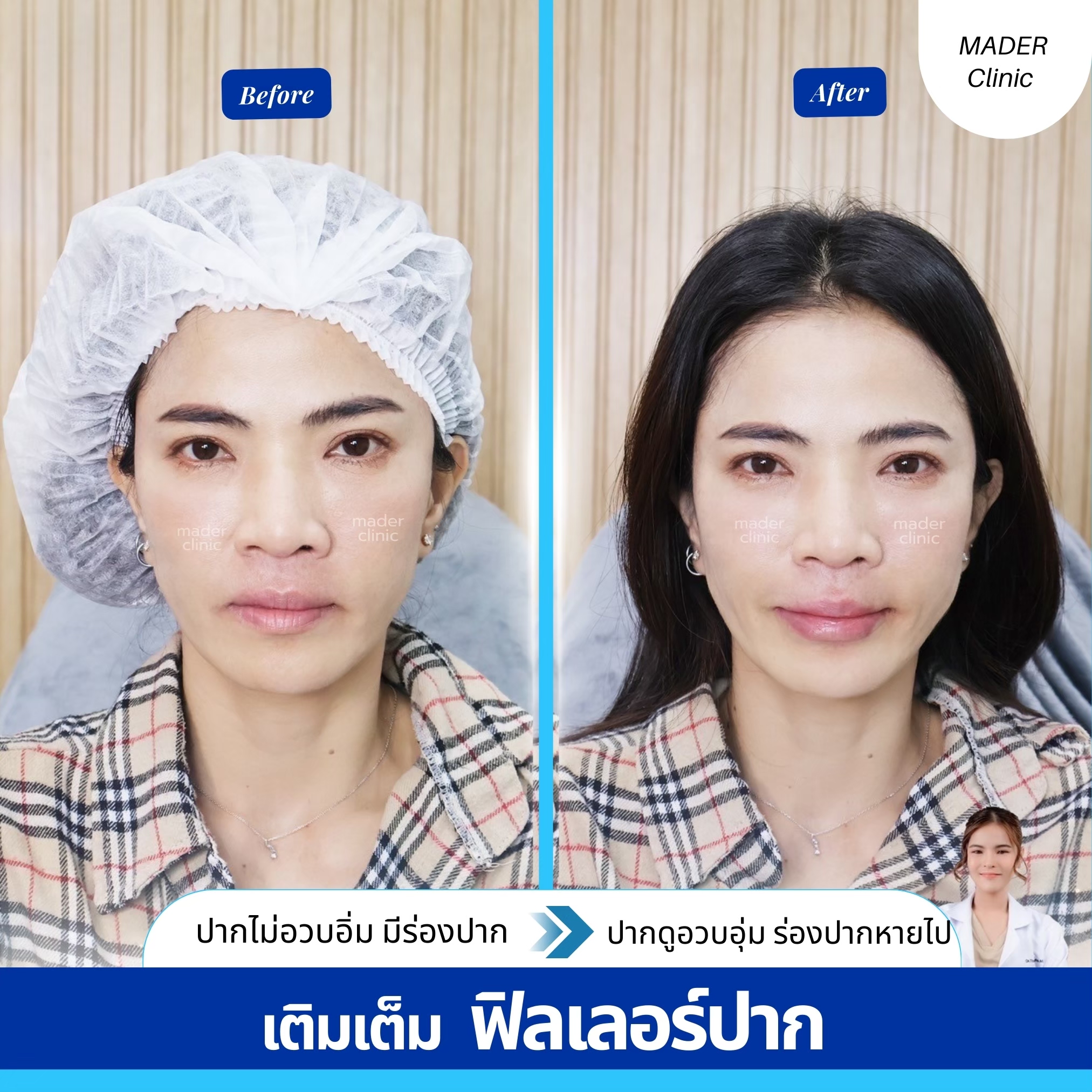 รีวิว MADER Clinic