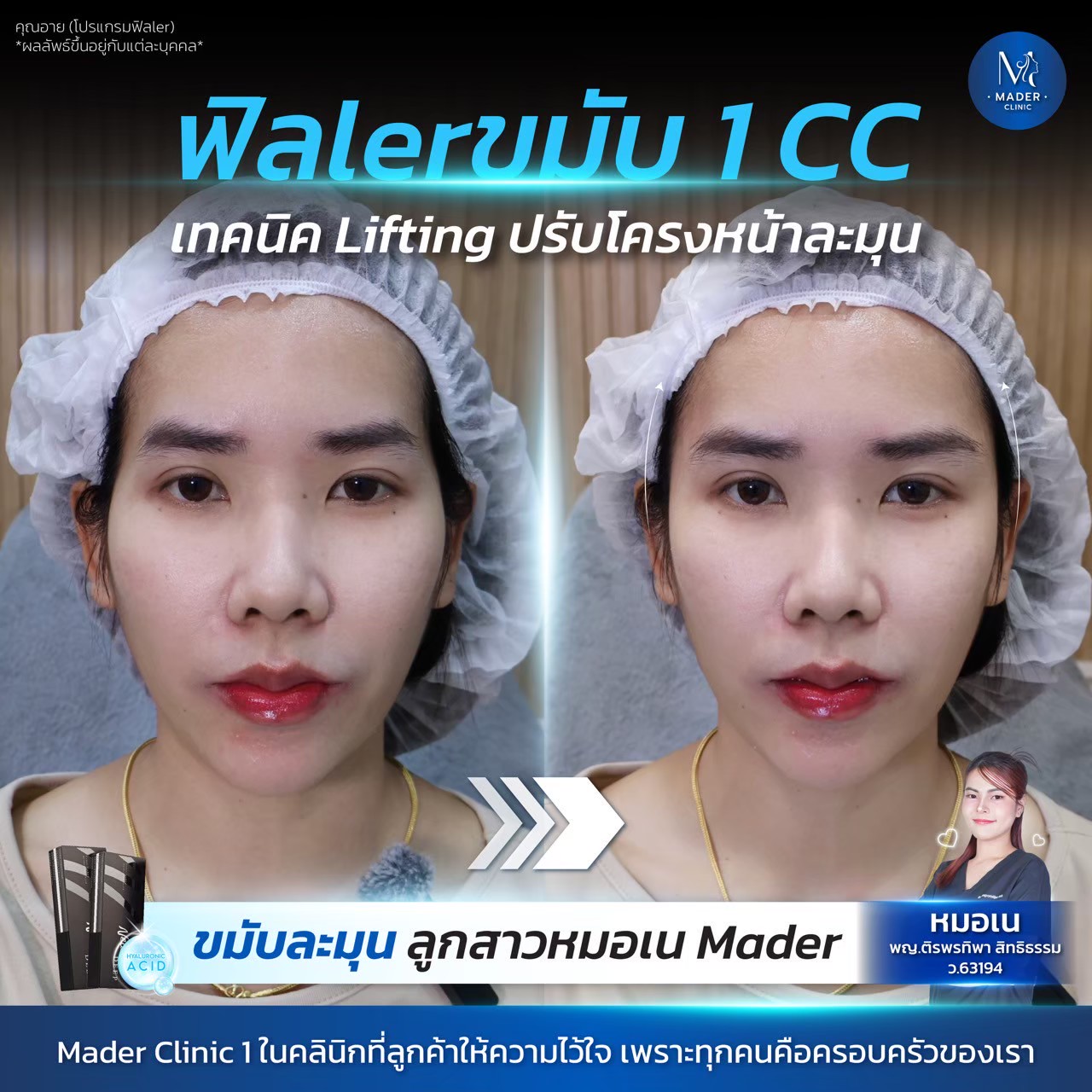 รีวิว MADER Clinic