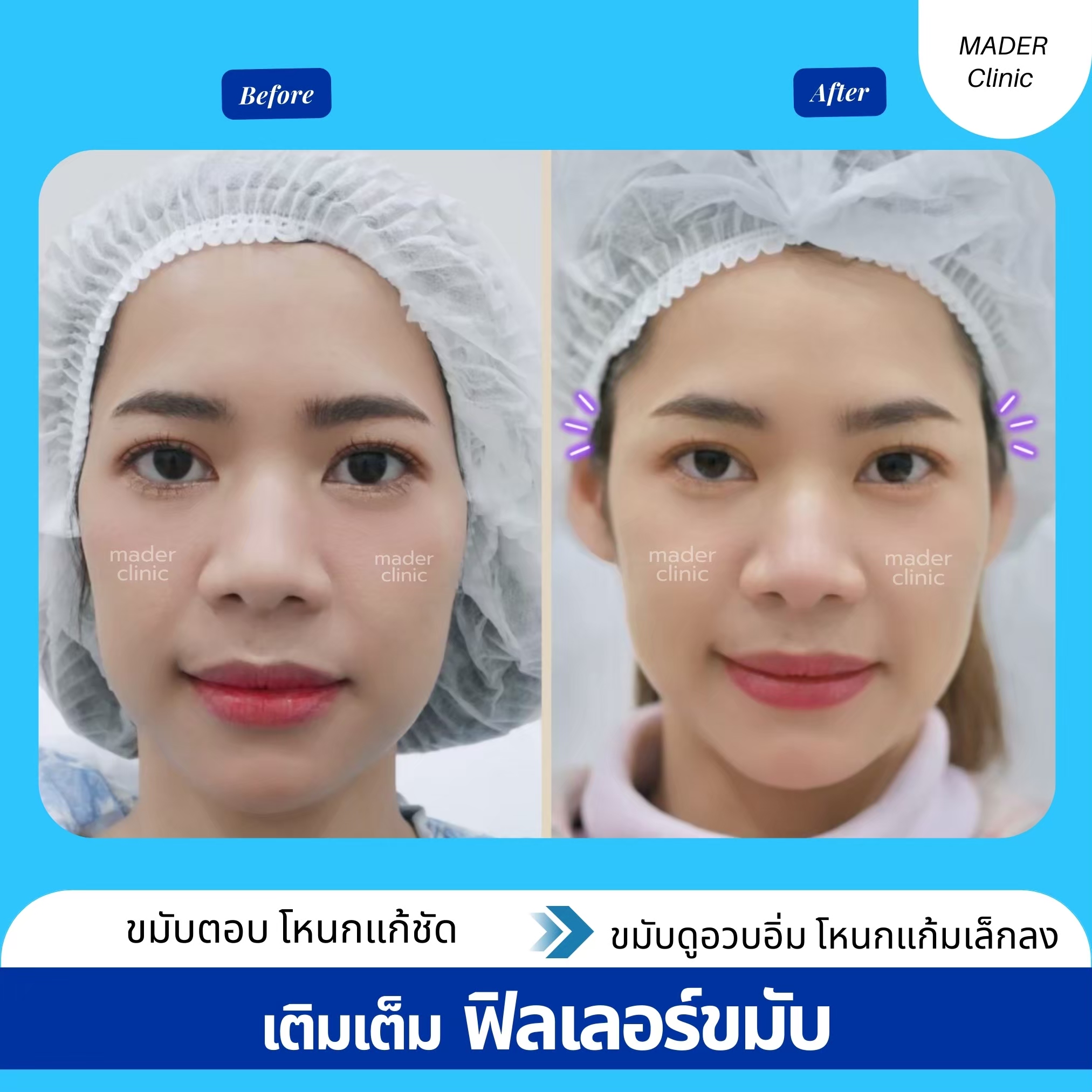 รีวิว MADER Clinic