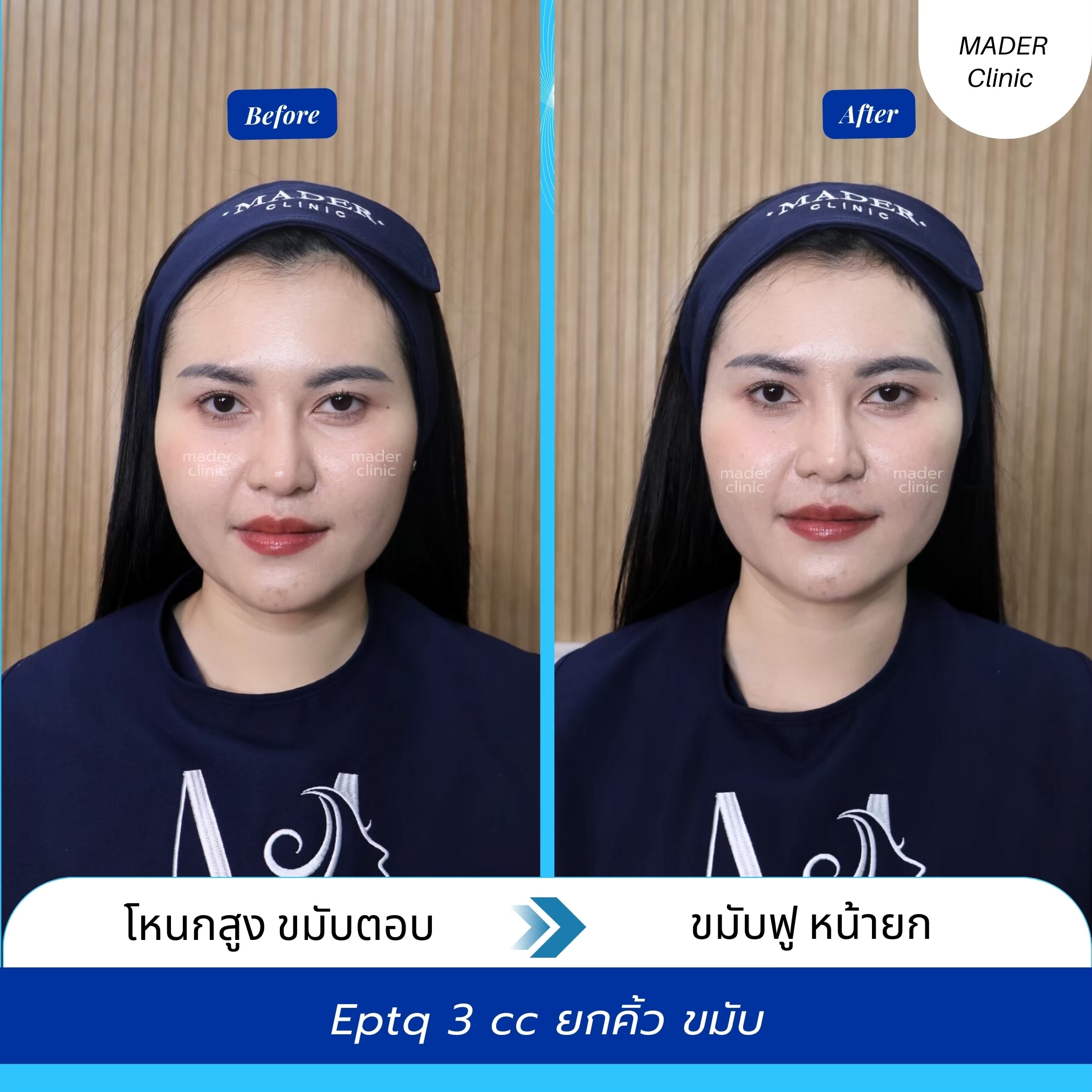 รีวิว MADER Clinic