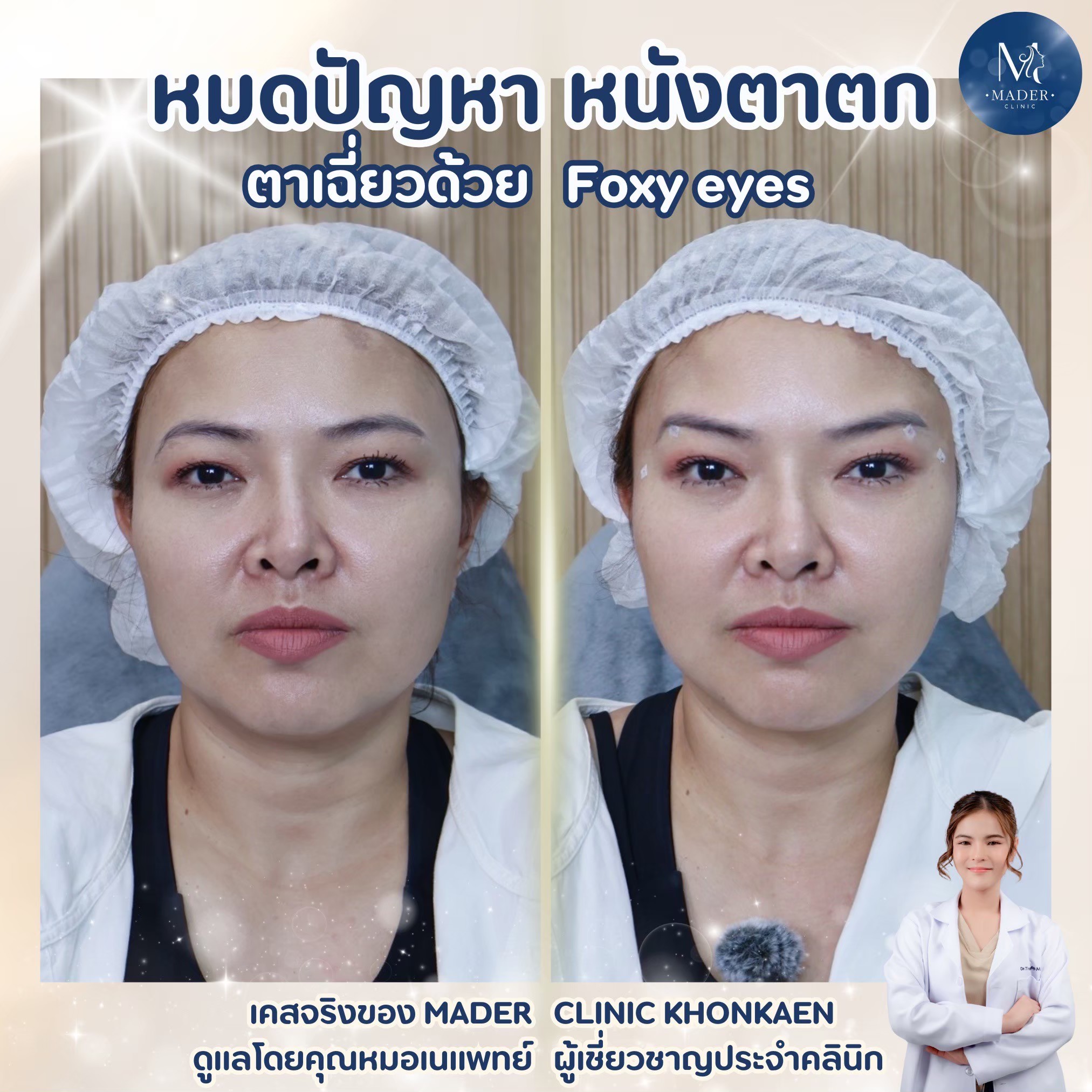 รีวิว MADER Clinic