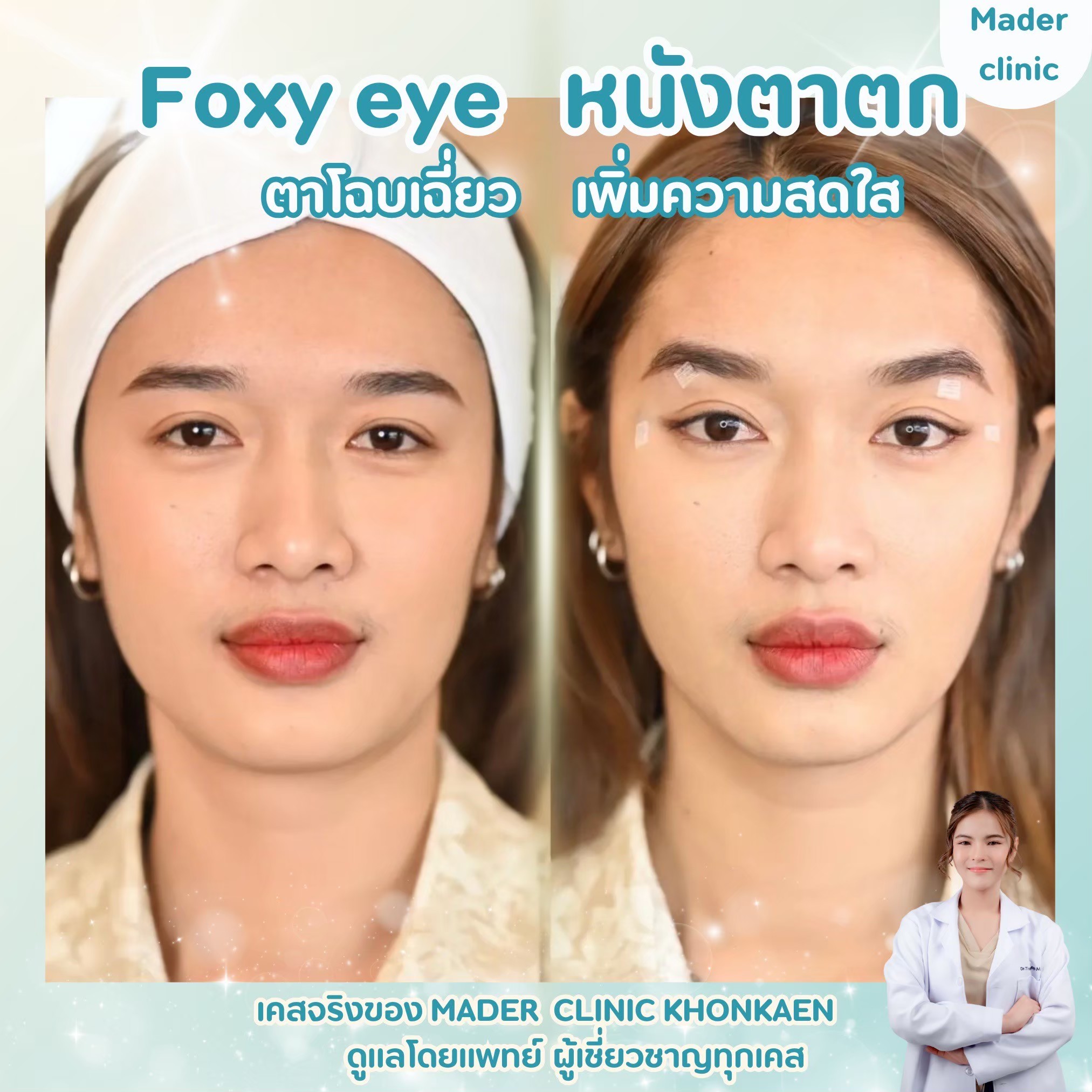 รีวิว MADER Clinic