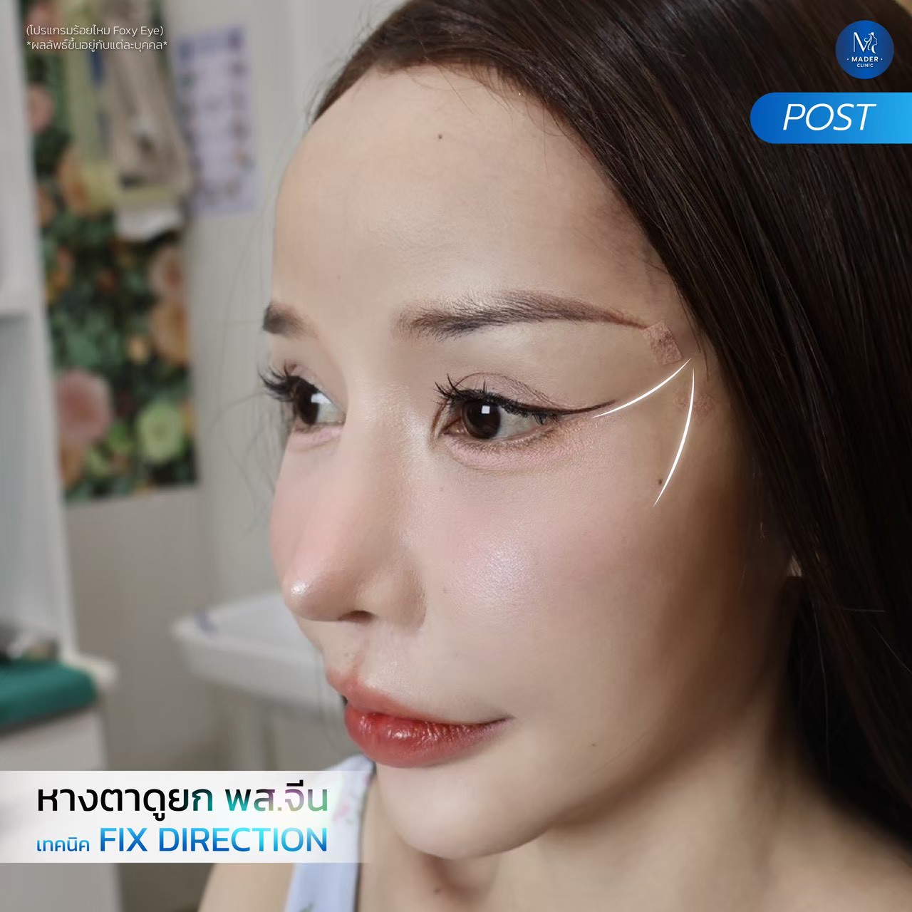 รีวิว Foxy Eye ยกหางตา