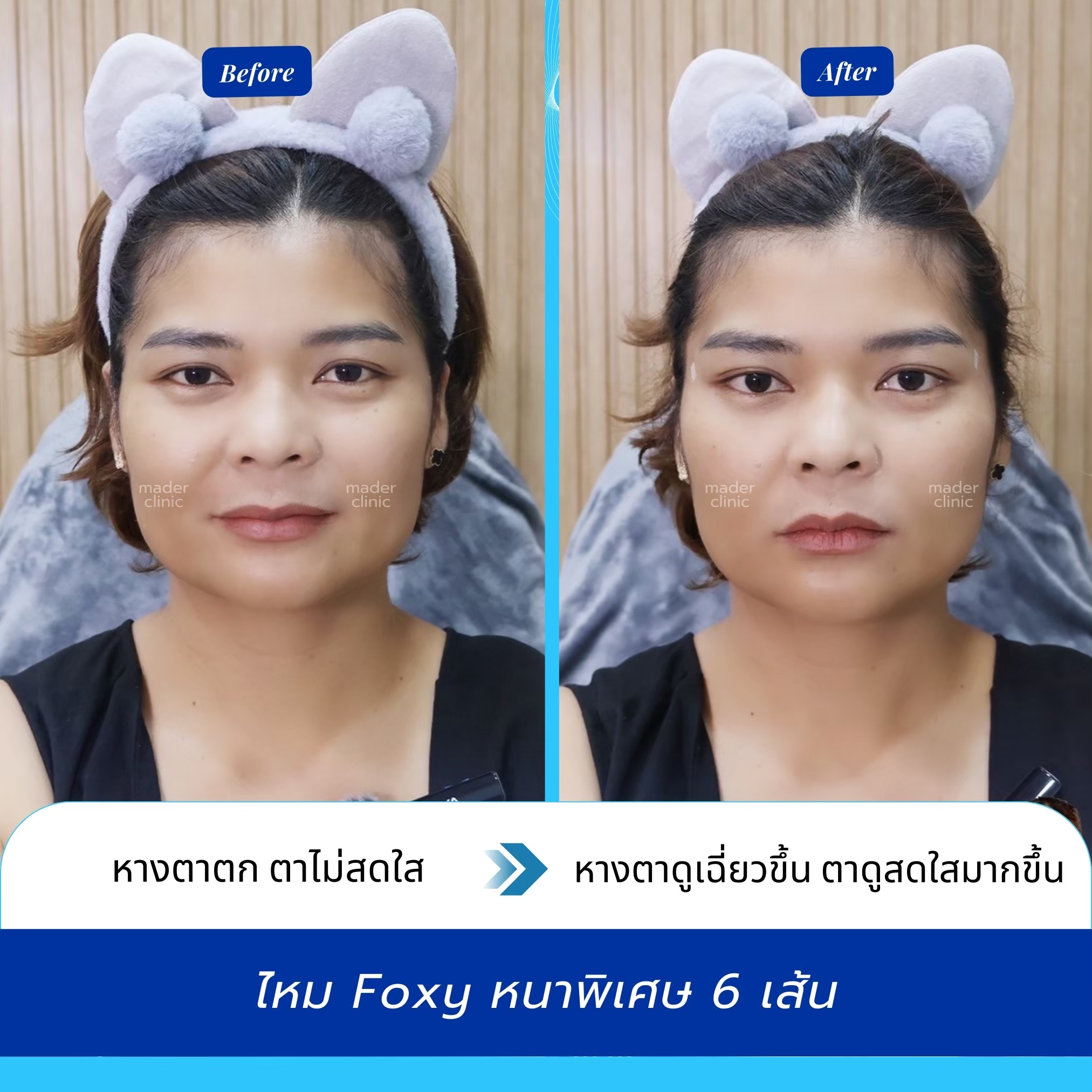 รีวิว MADER Clinic