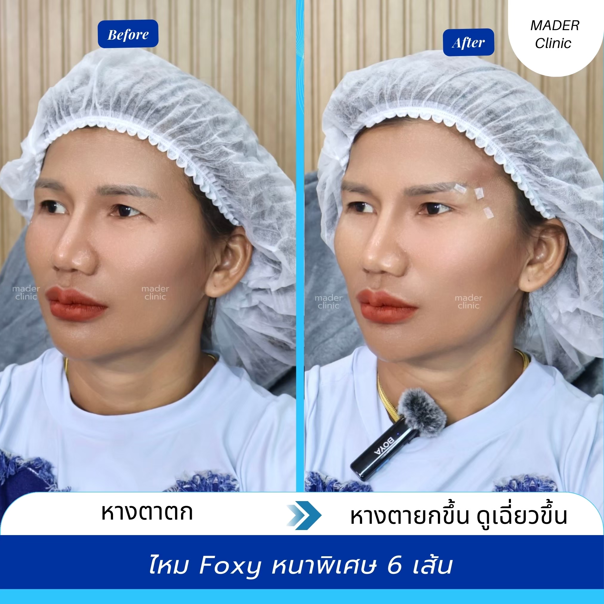รีวิว MADER Clinic
