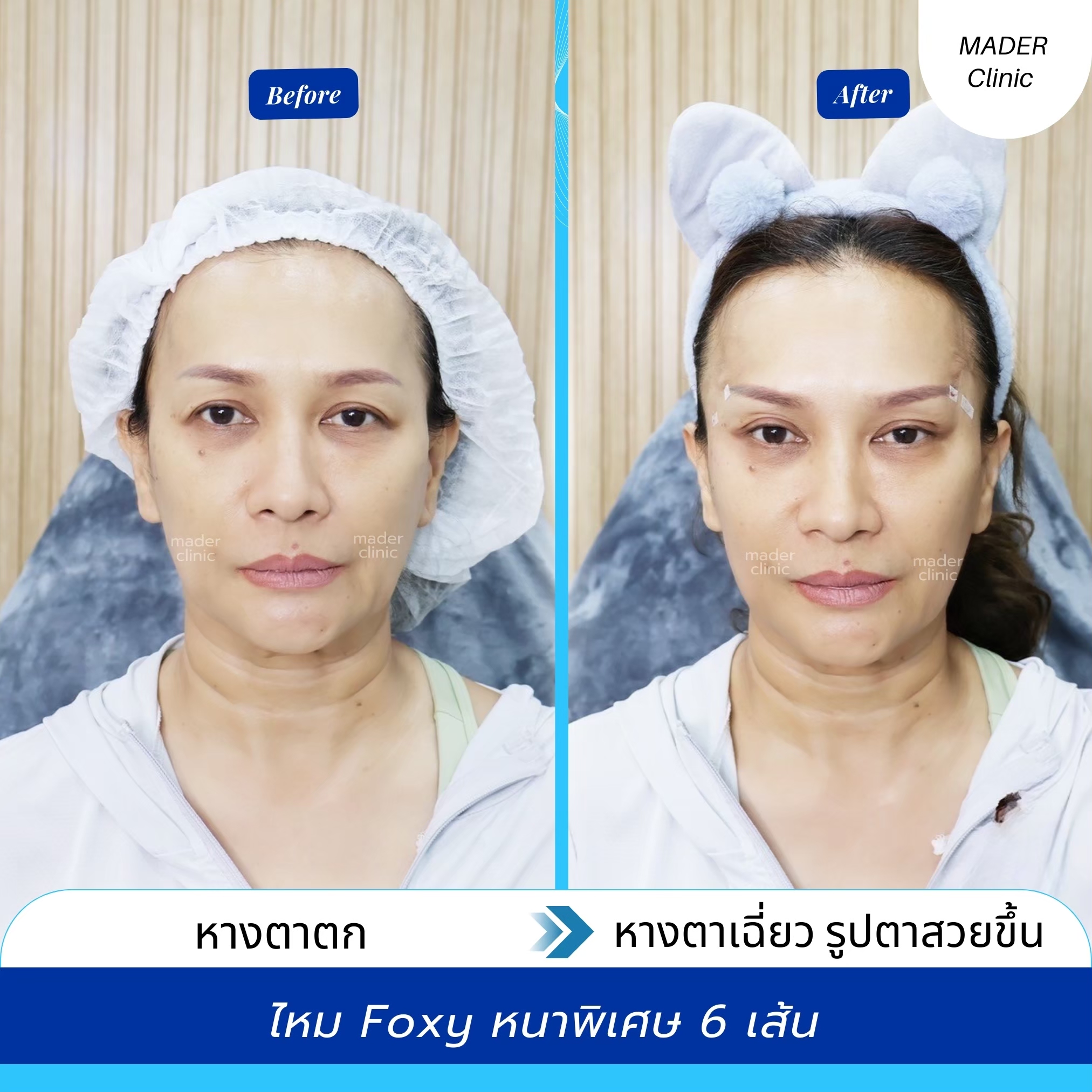 รีวิว MADER Clinic