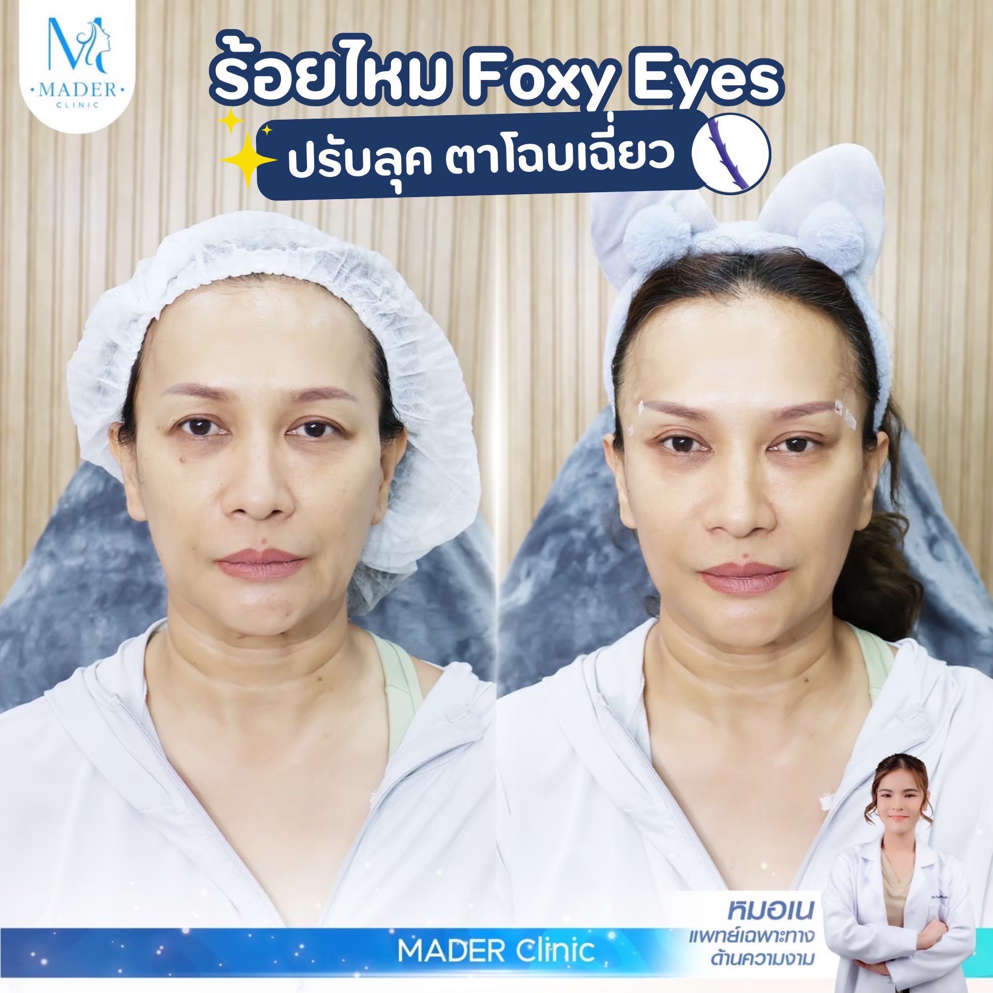รีวิว MADER Clinic
