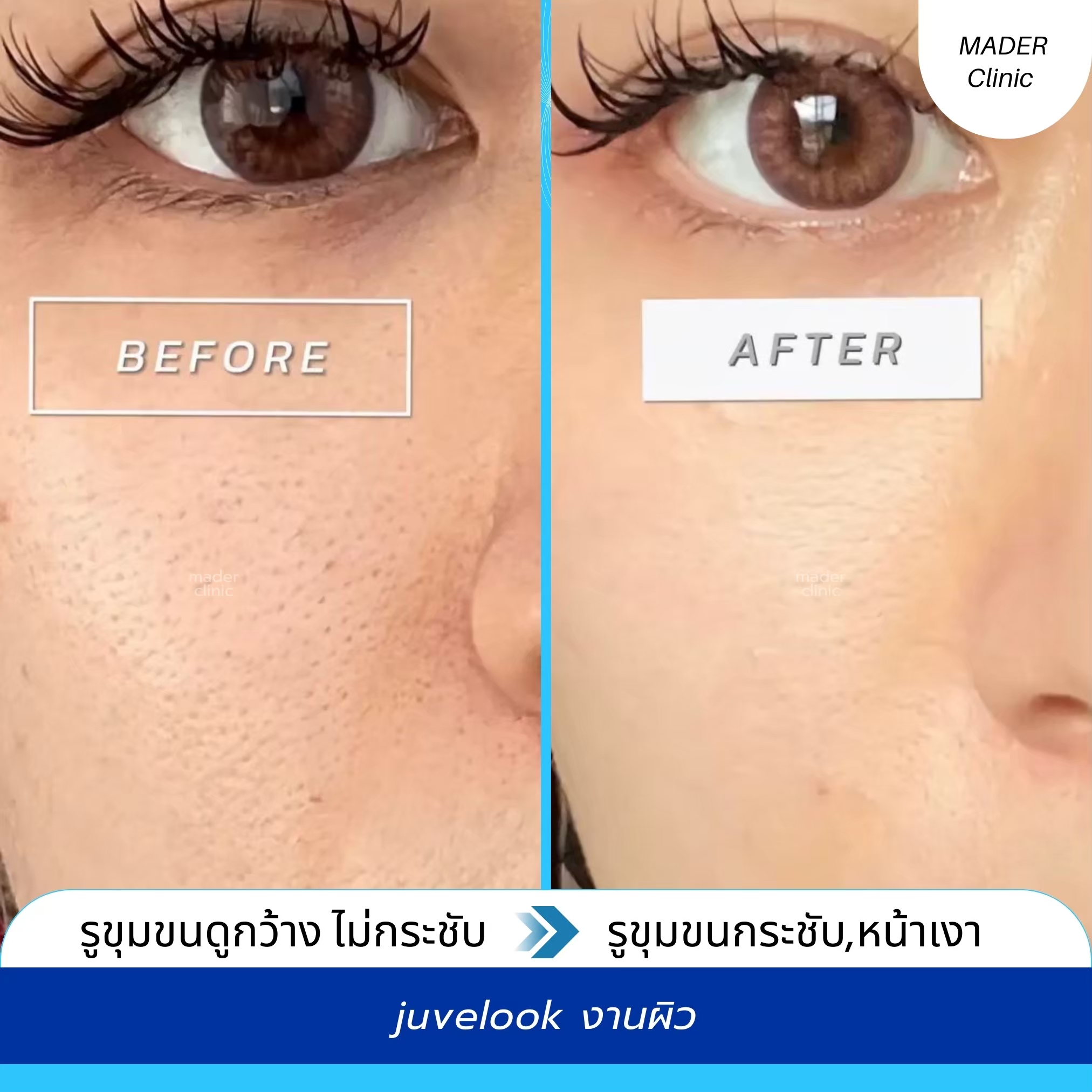 รีวิว MADER Clinic