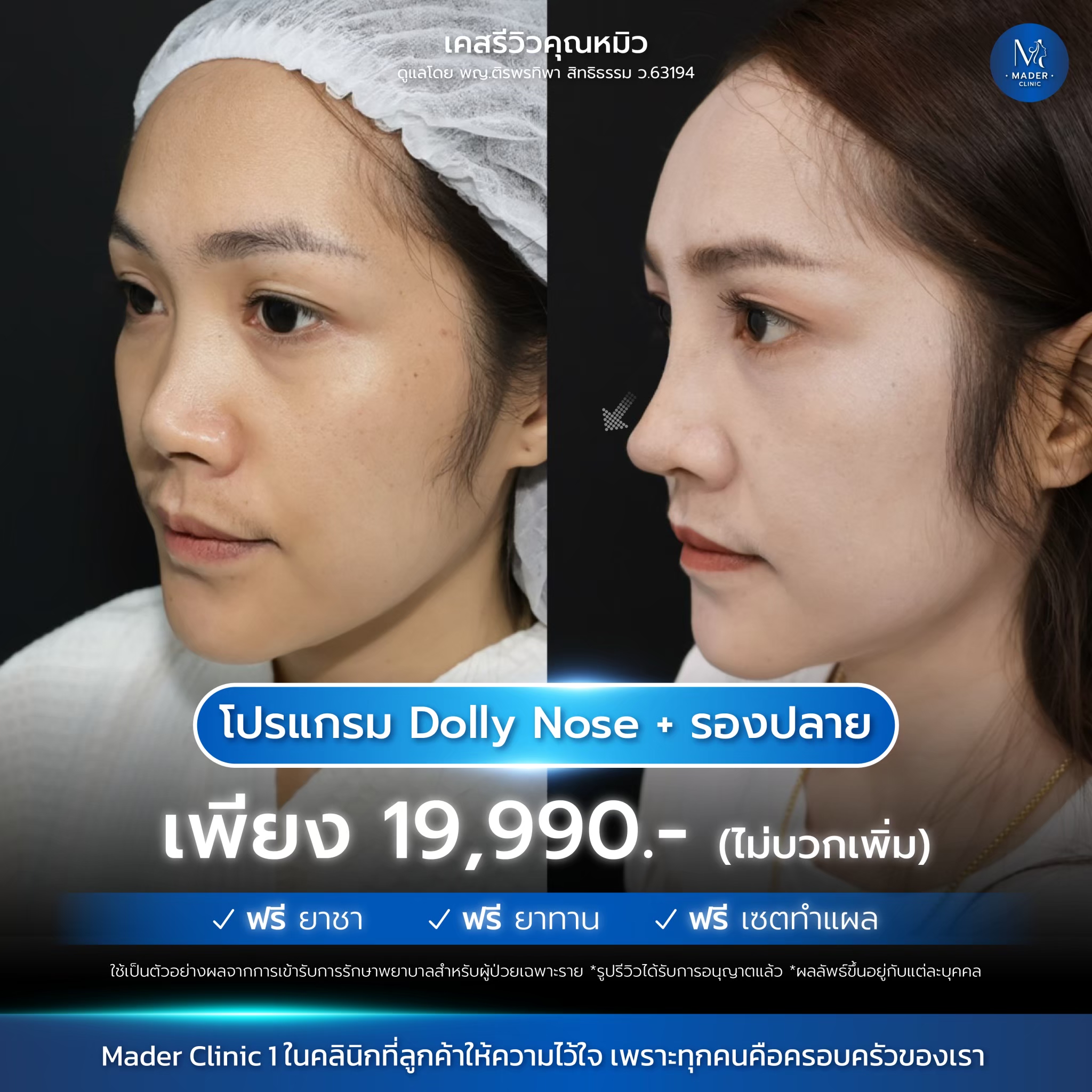 รีวิว MADER Clinic