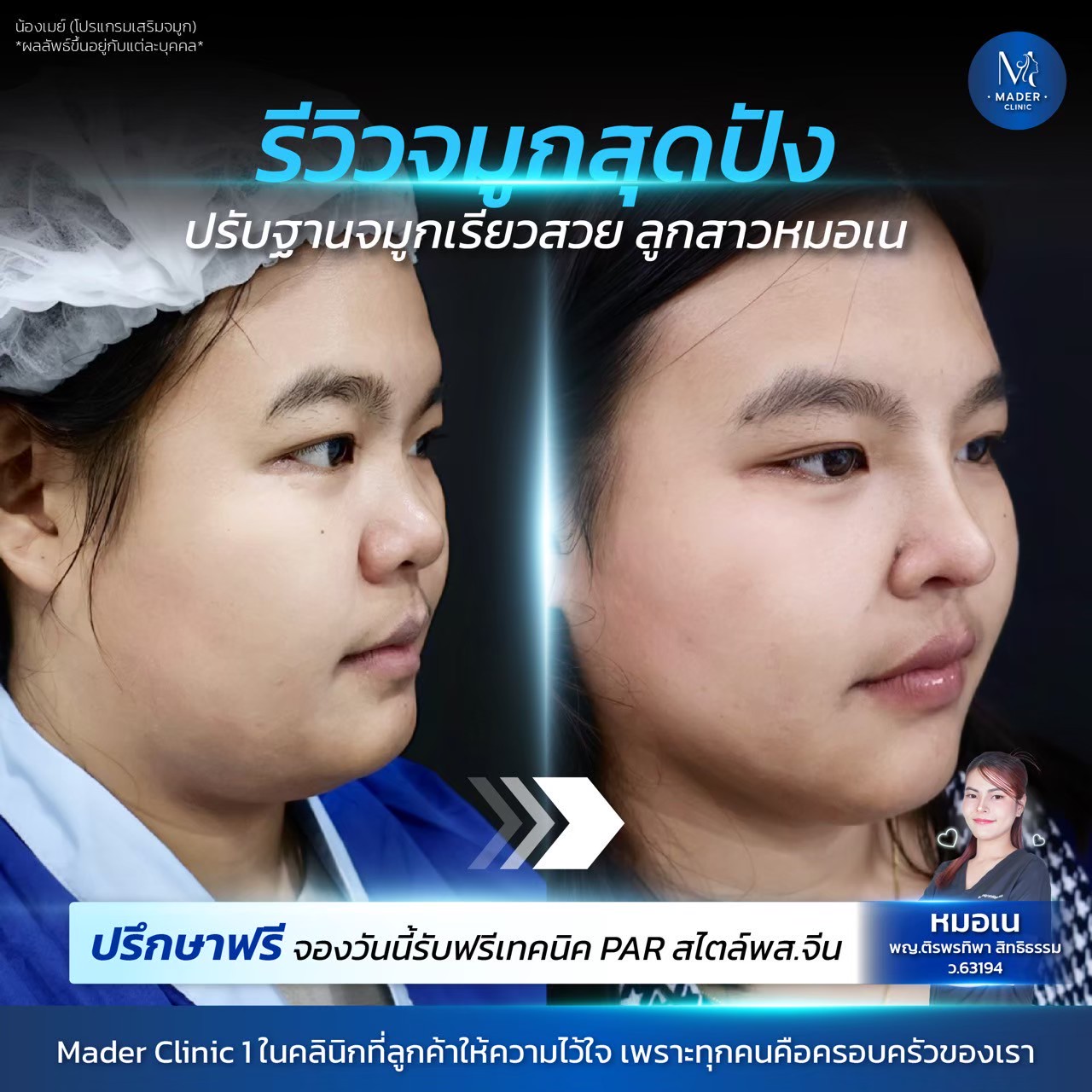 รีวิว MADER Clinic