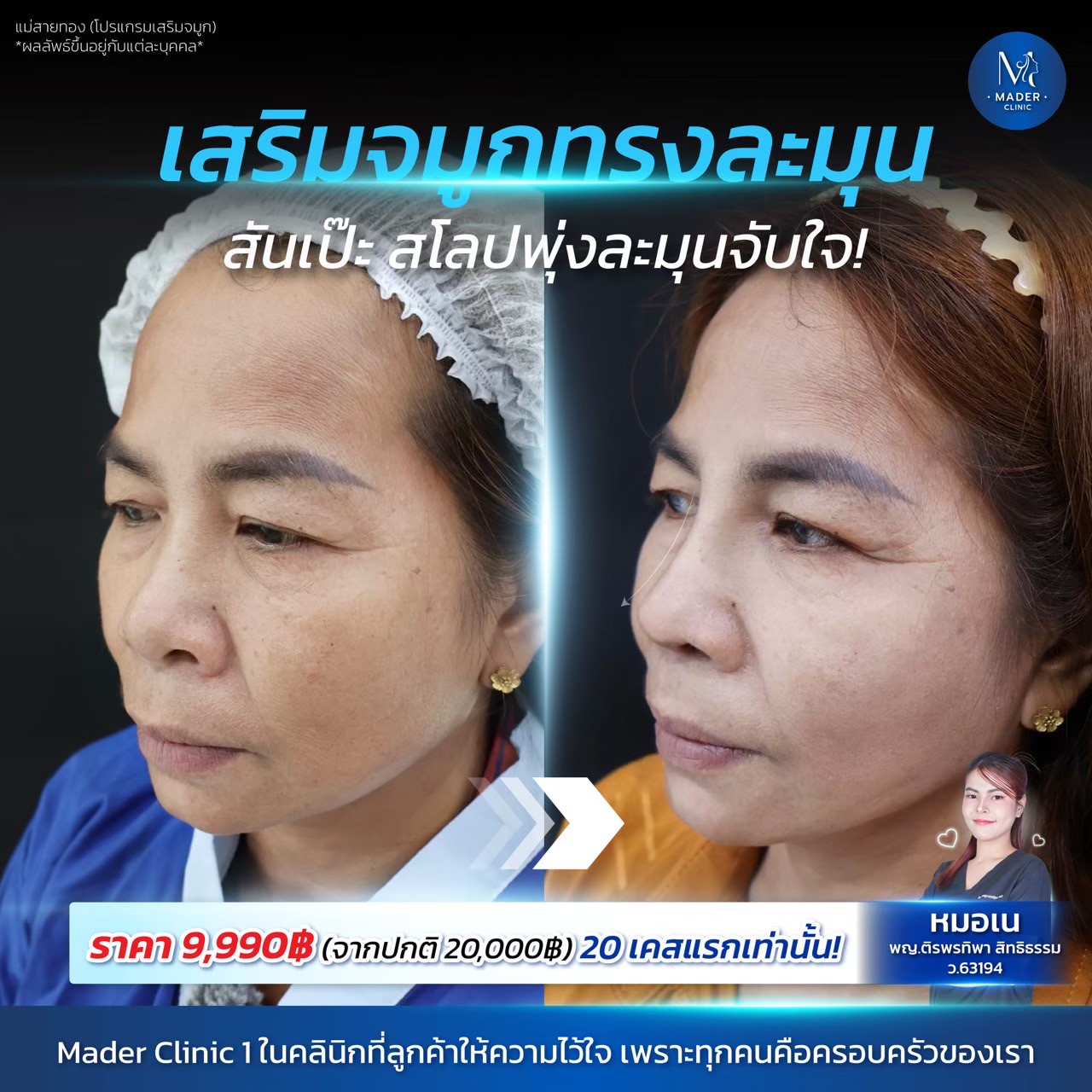 รีวิว MADER Clinic
