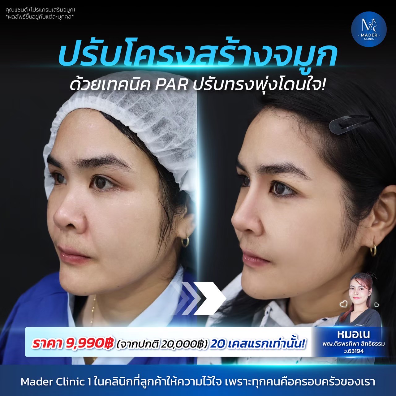 รีวิว MADER Clinic