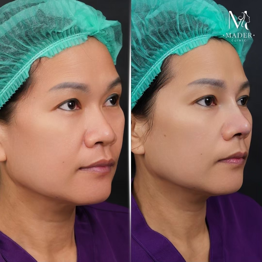 รีวิว MADER Clinic