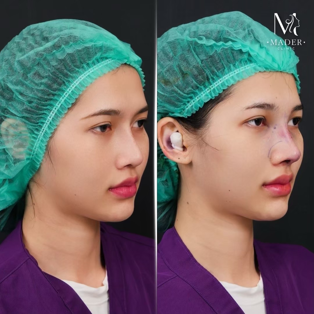 รีวิว MADER Clinic