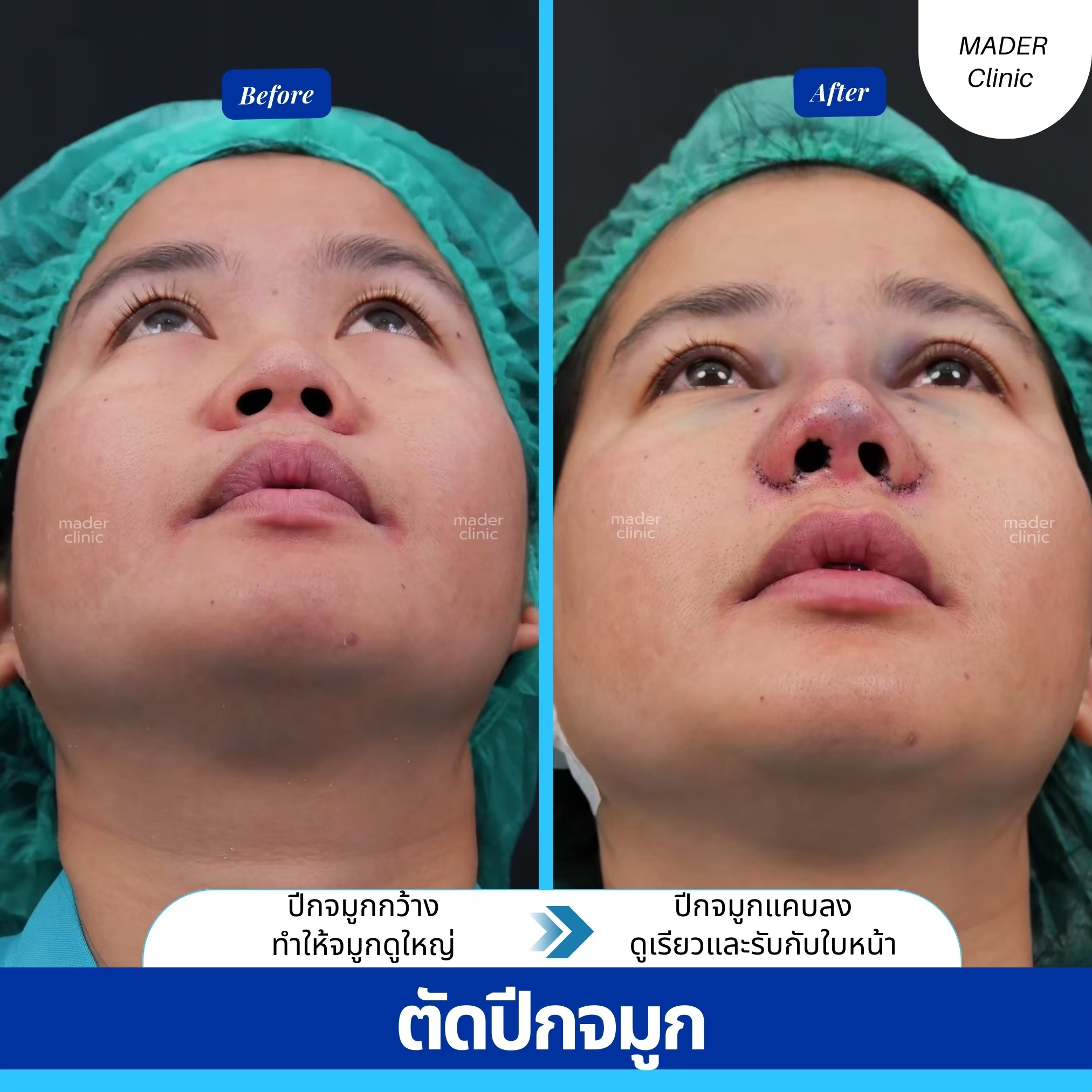 รีวิว MADER Clinic