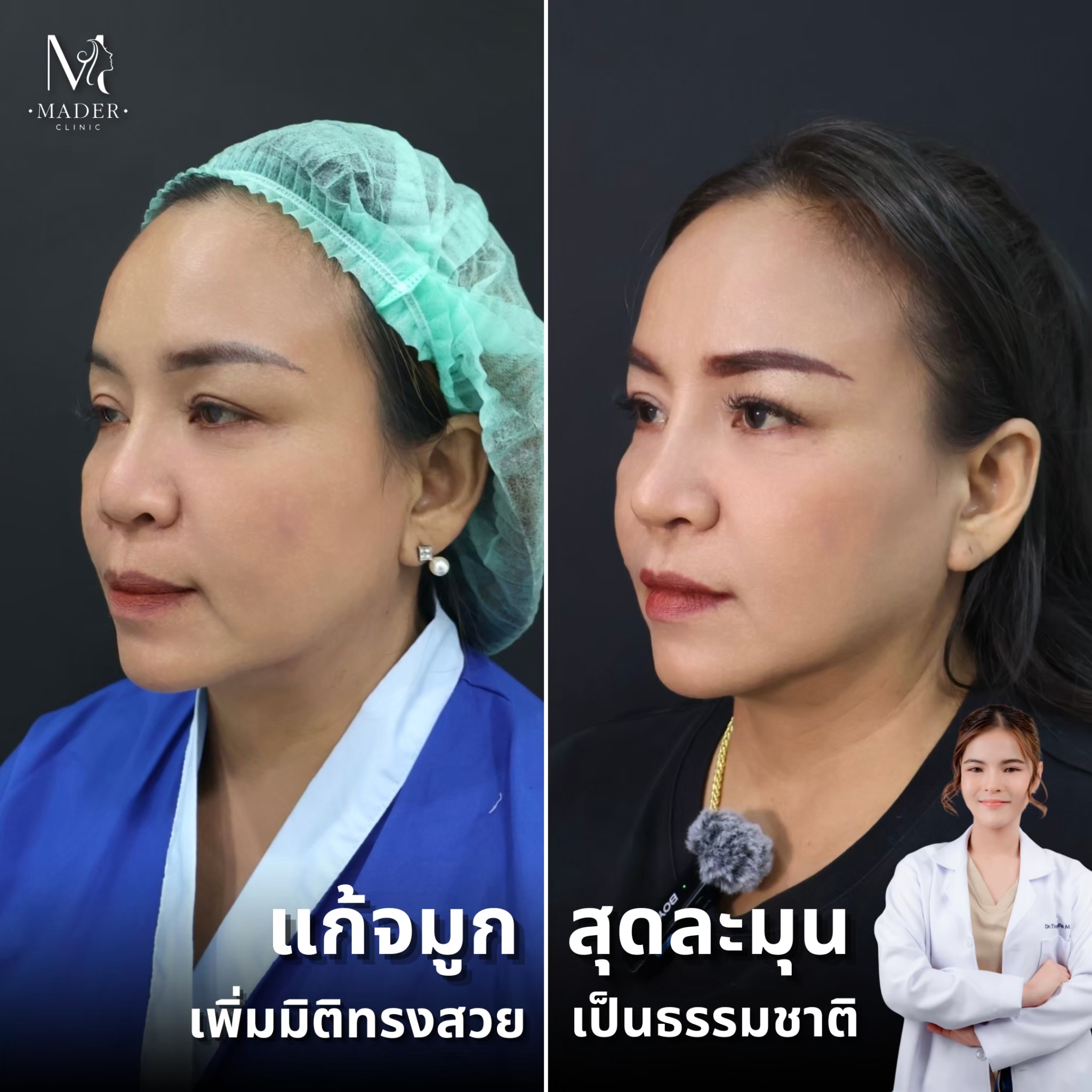 รีวิว MADER Clinic