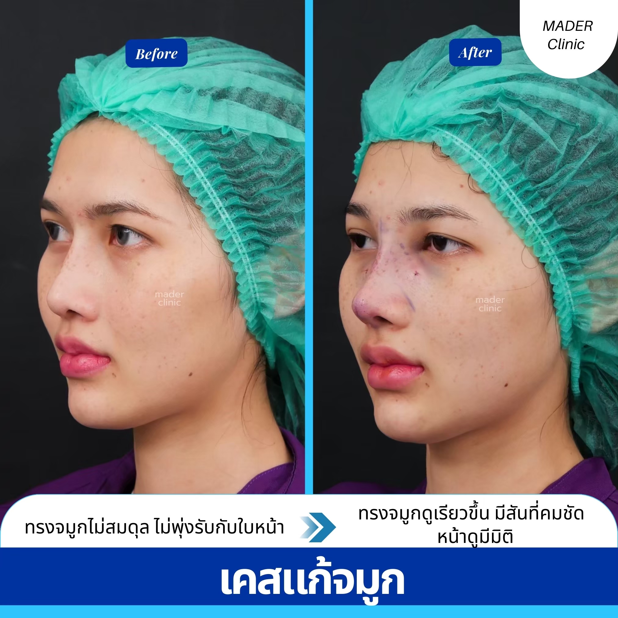รีวิว MADER Clinic