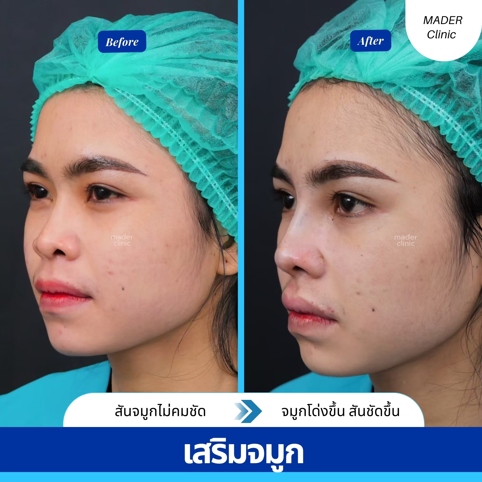 รีวิว MADER Clinic