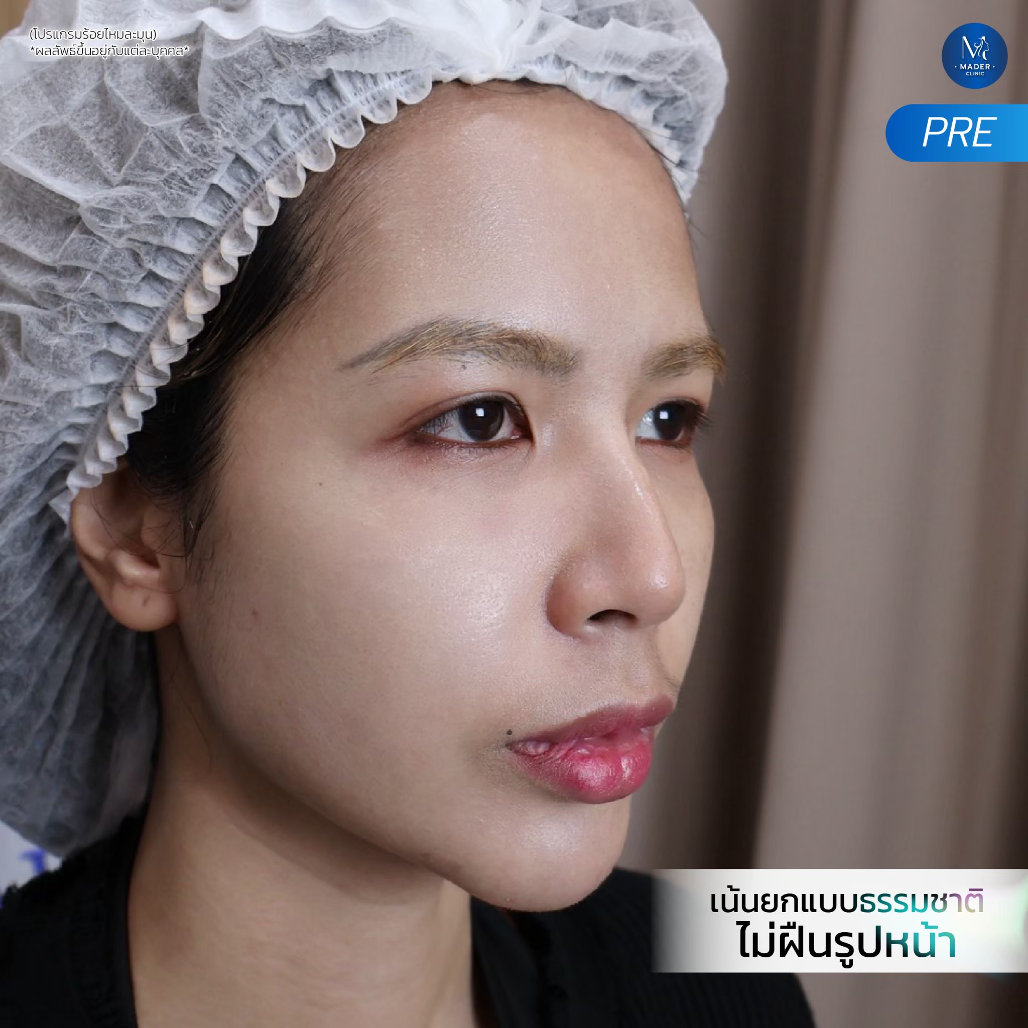 รีวิว MADER Clinic