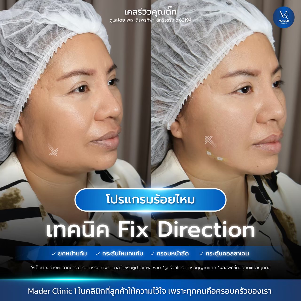 รีวิว MADER Clinic