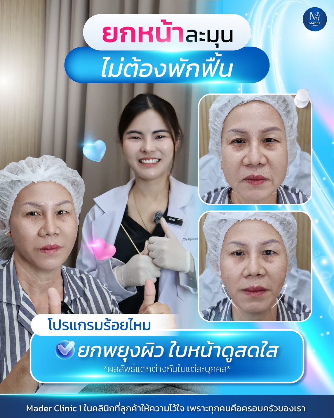 รีวิว MADER Clinic