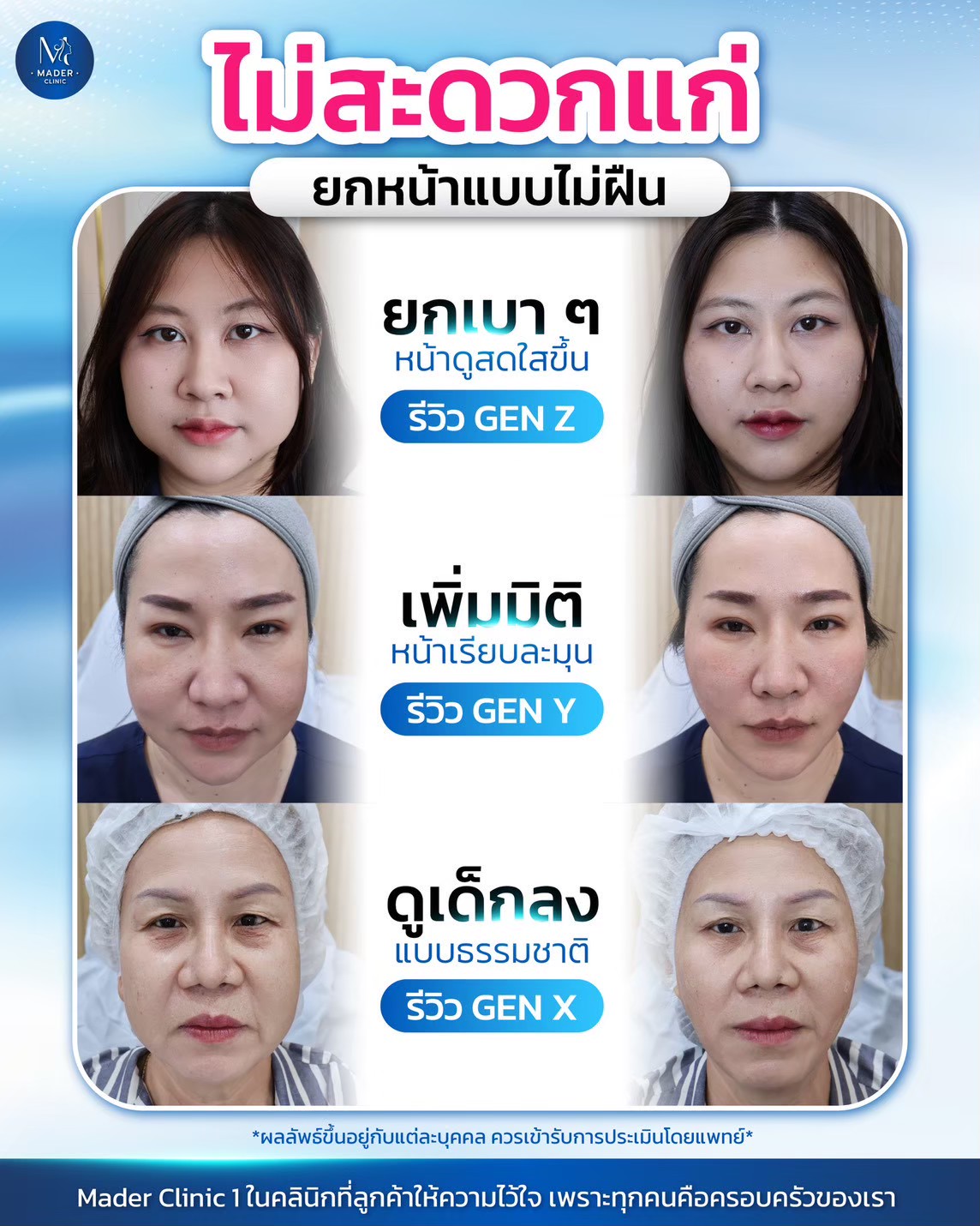 รีวิว MADER Clinic