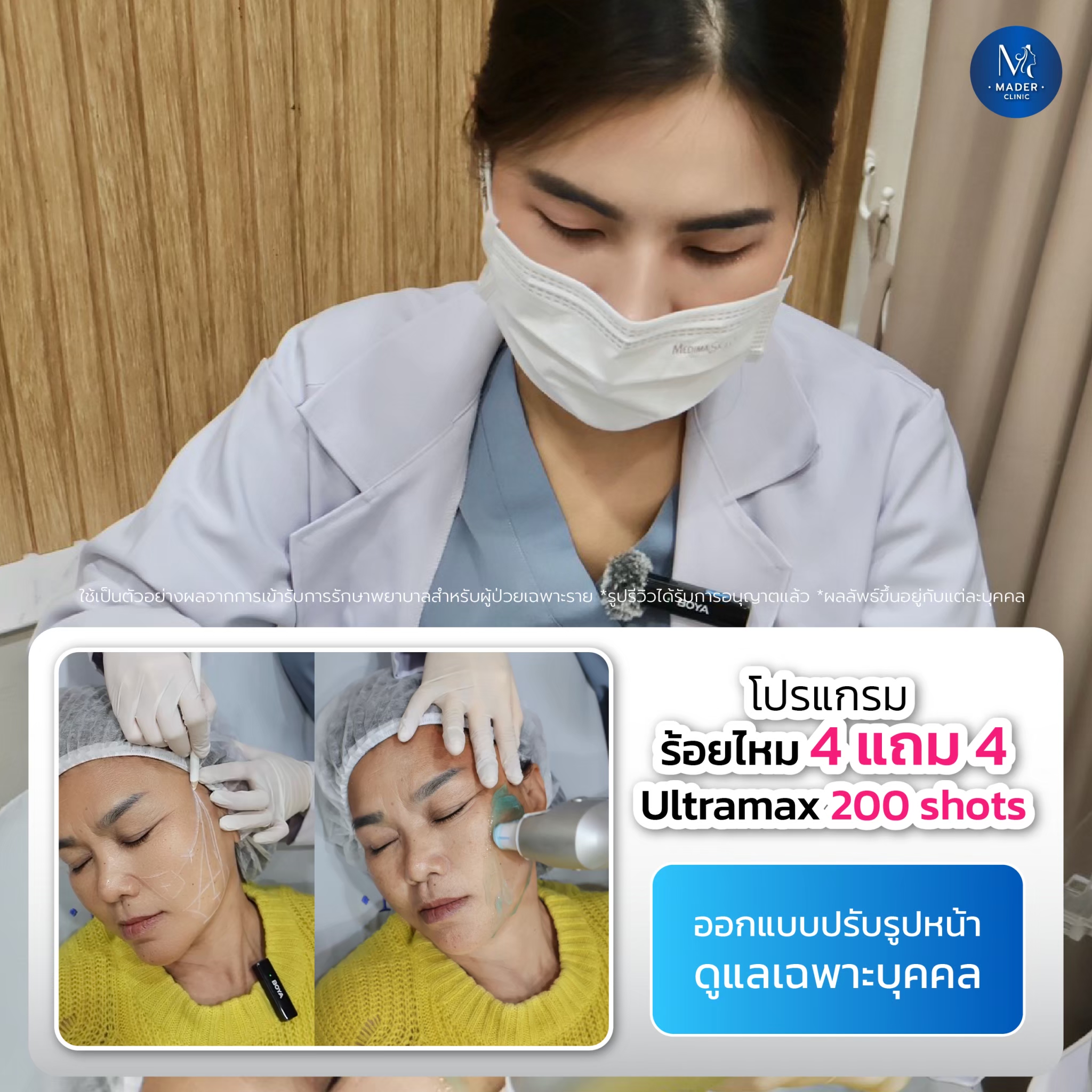รีวิว MADER Clinic